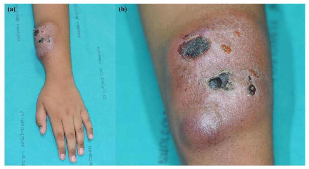 Dermatopathology 09 00038 g001