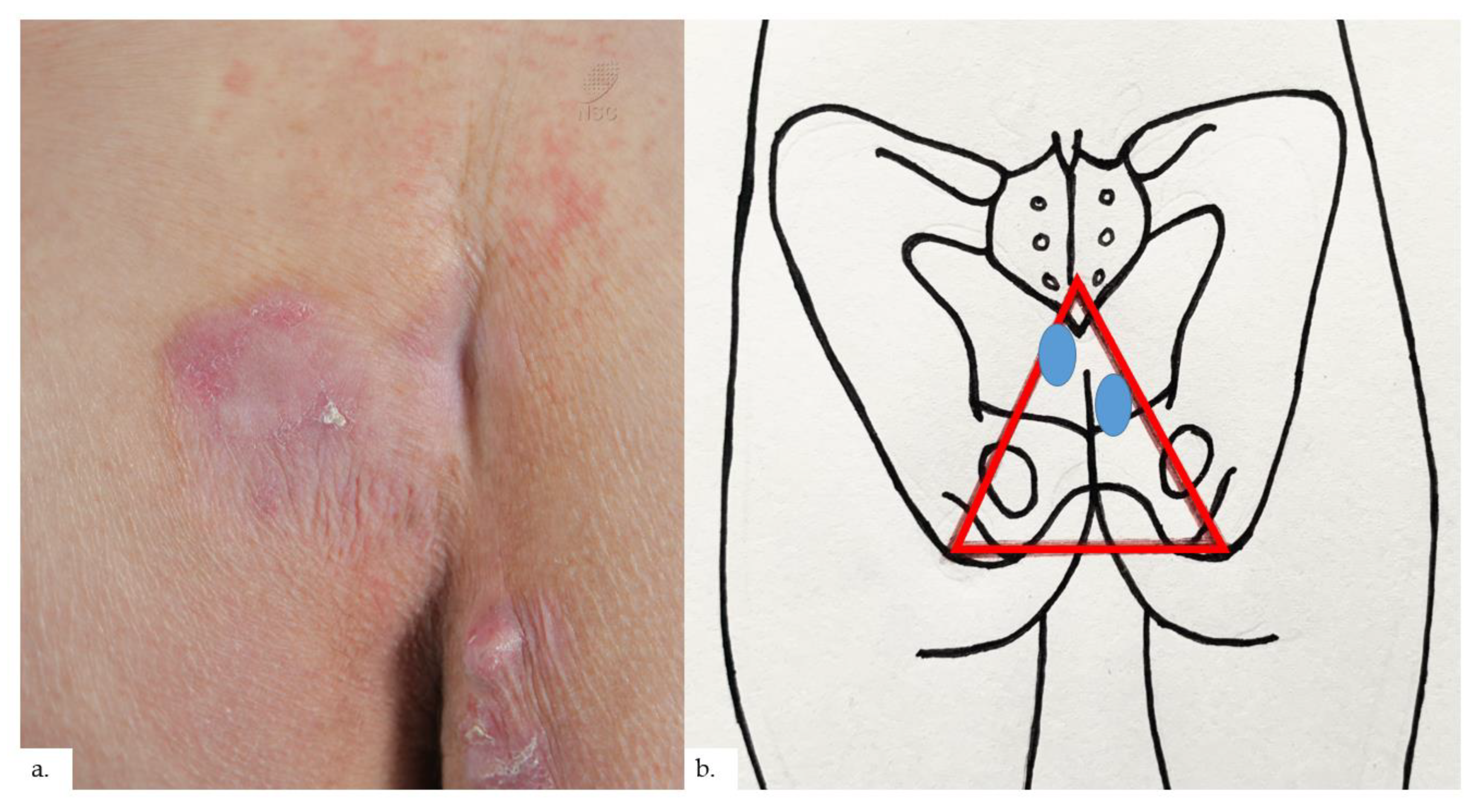 Dermatopathology 09 00040 g003