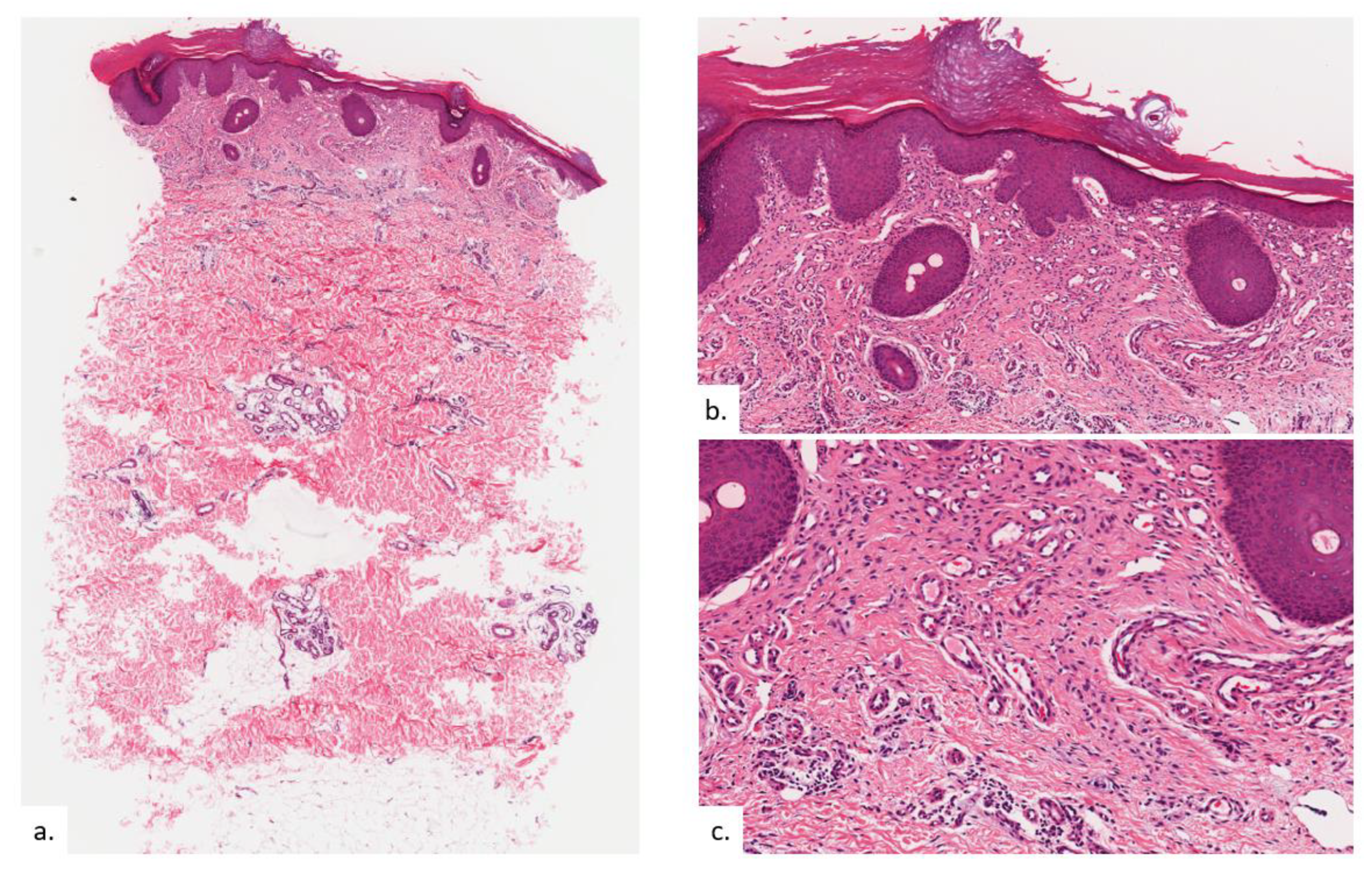 Dermatopathology 09 00040 g006a