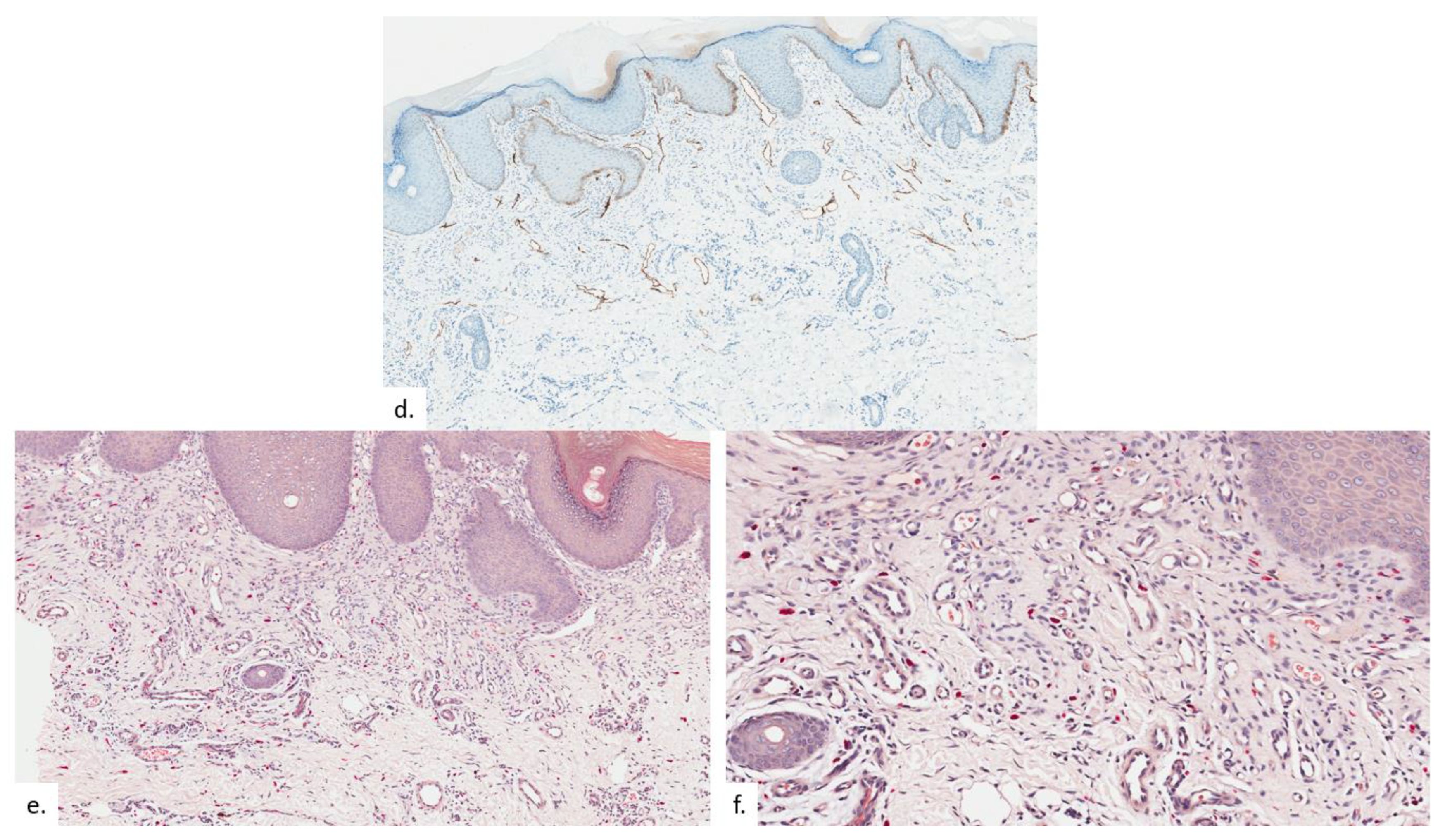 Dermatopathology 09 00040 g006b