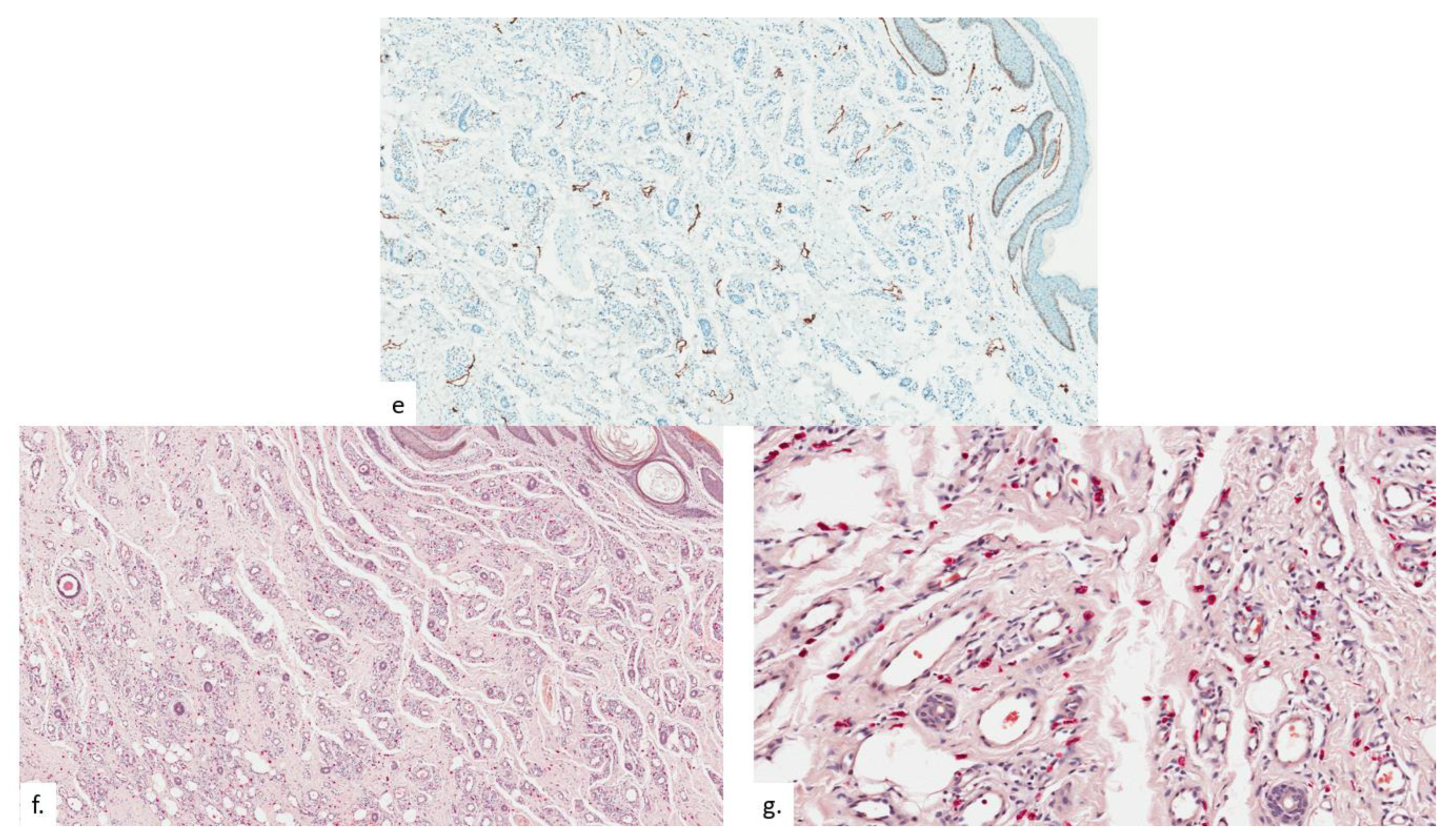 Dermatopathology 09 00040 g008b