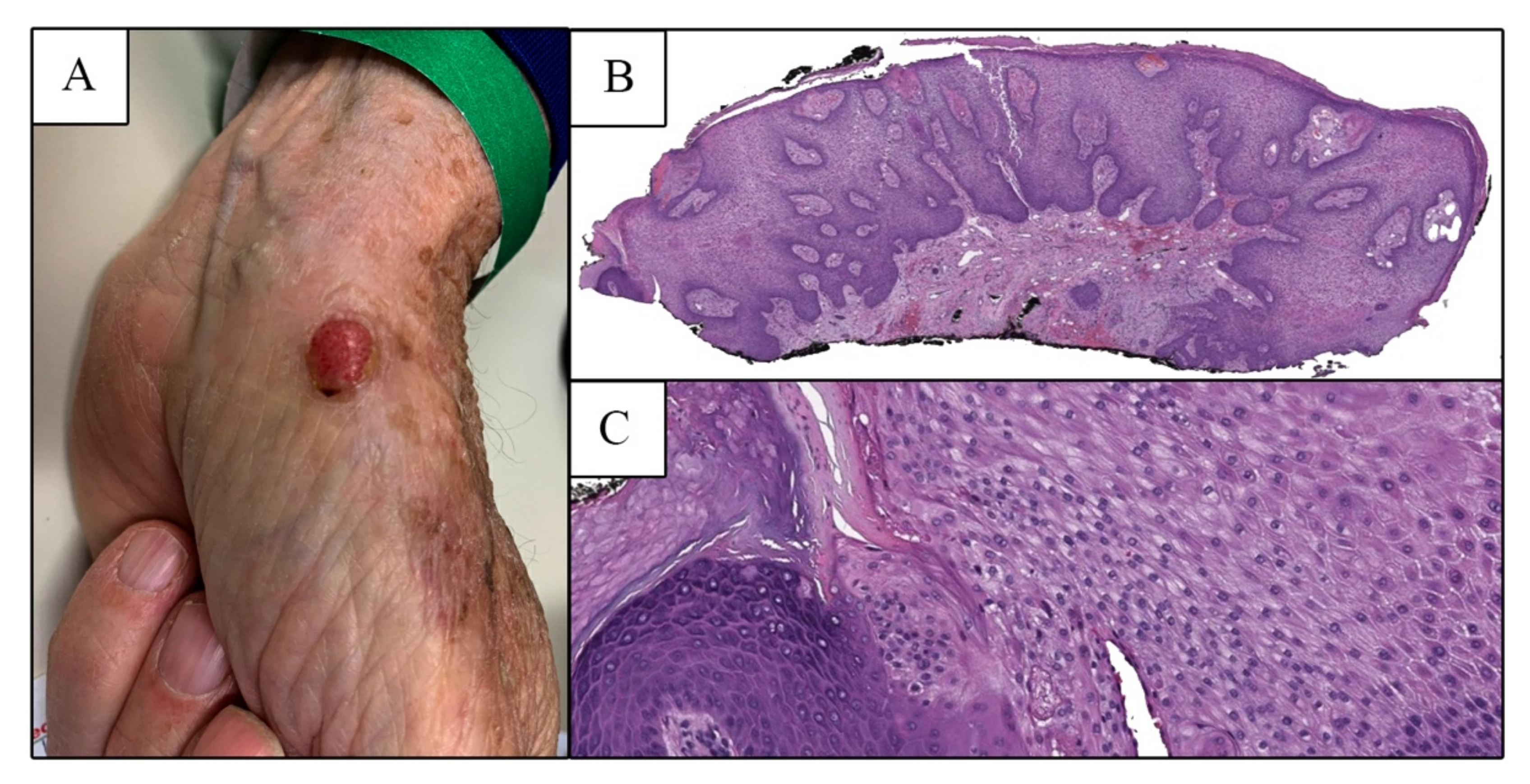 Dermatopathology 09 00041 g001