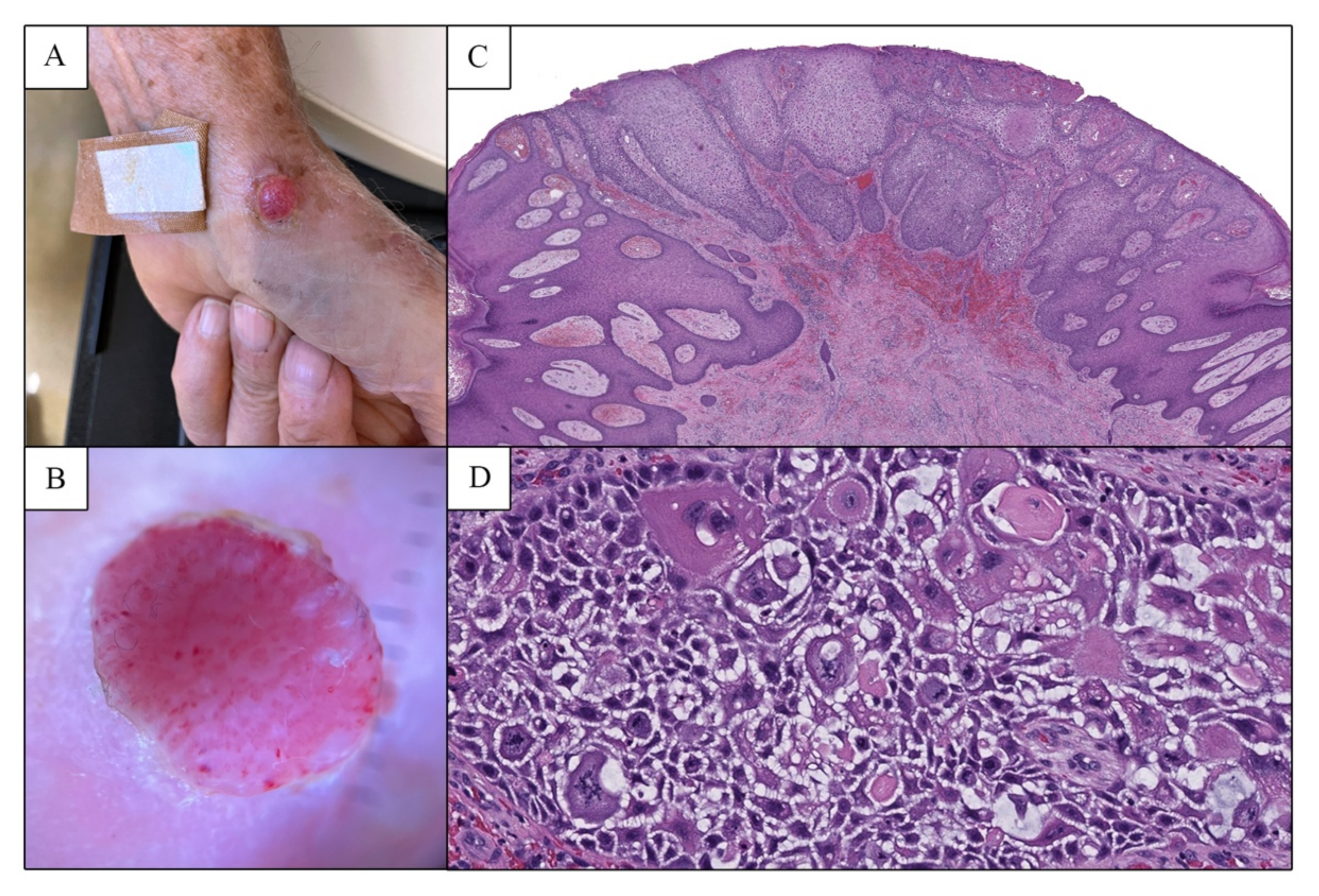 Dermatopathology 09 00041 g002
