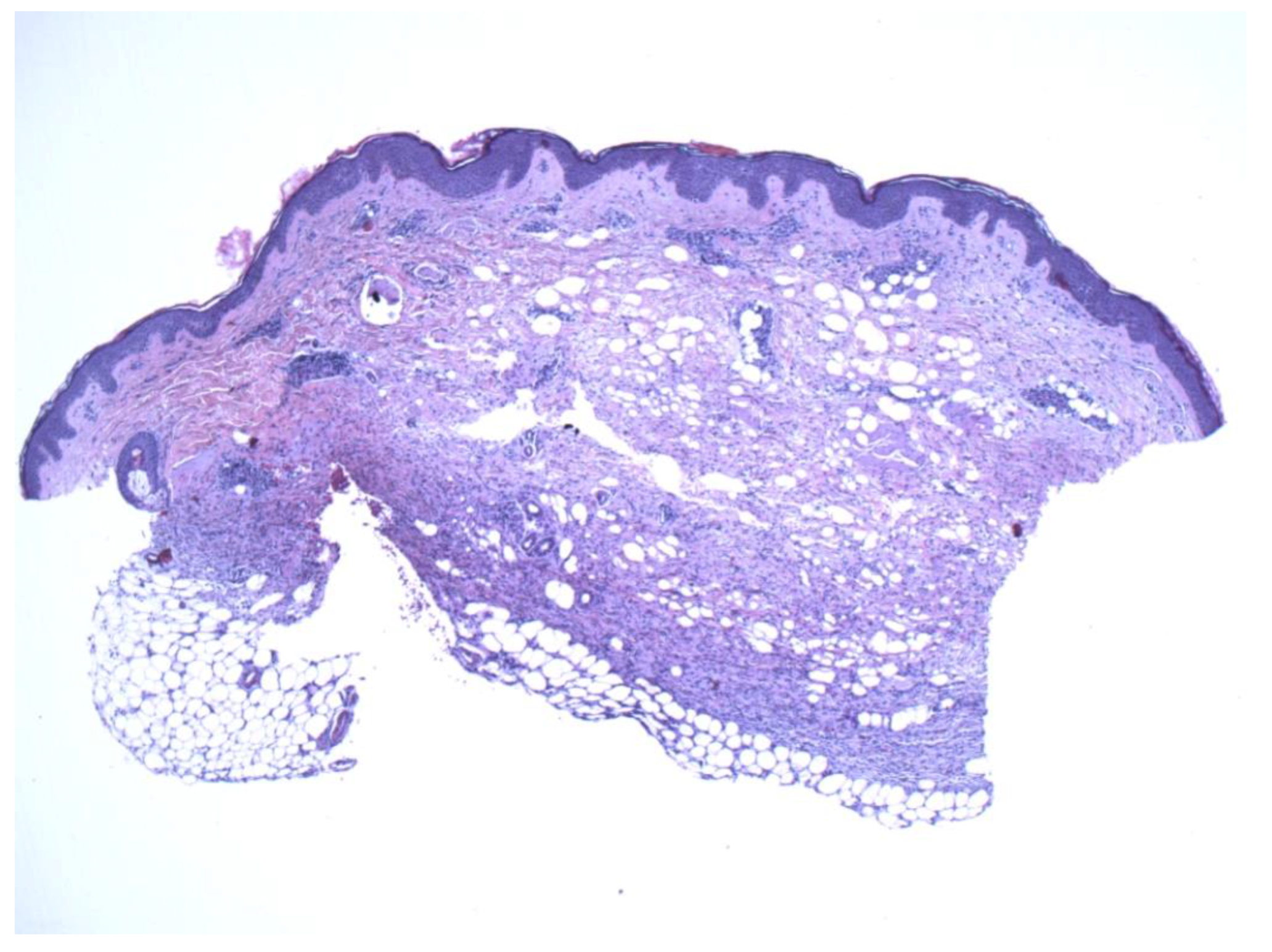 Dermatopathology 09 00044 g002