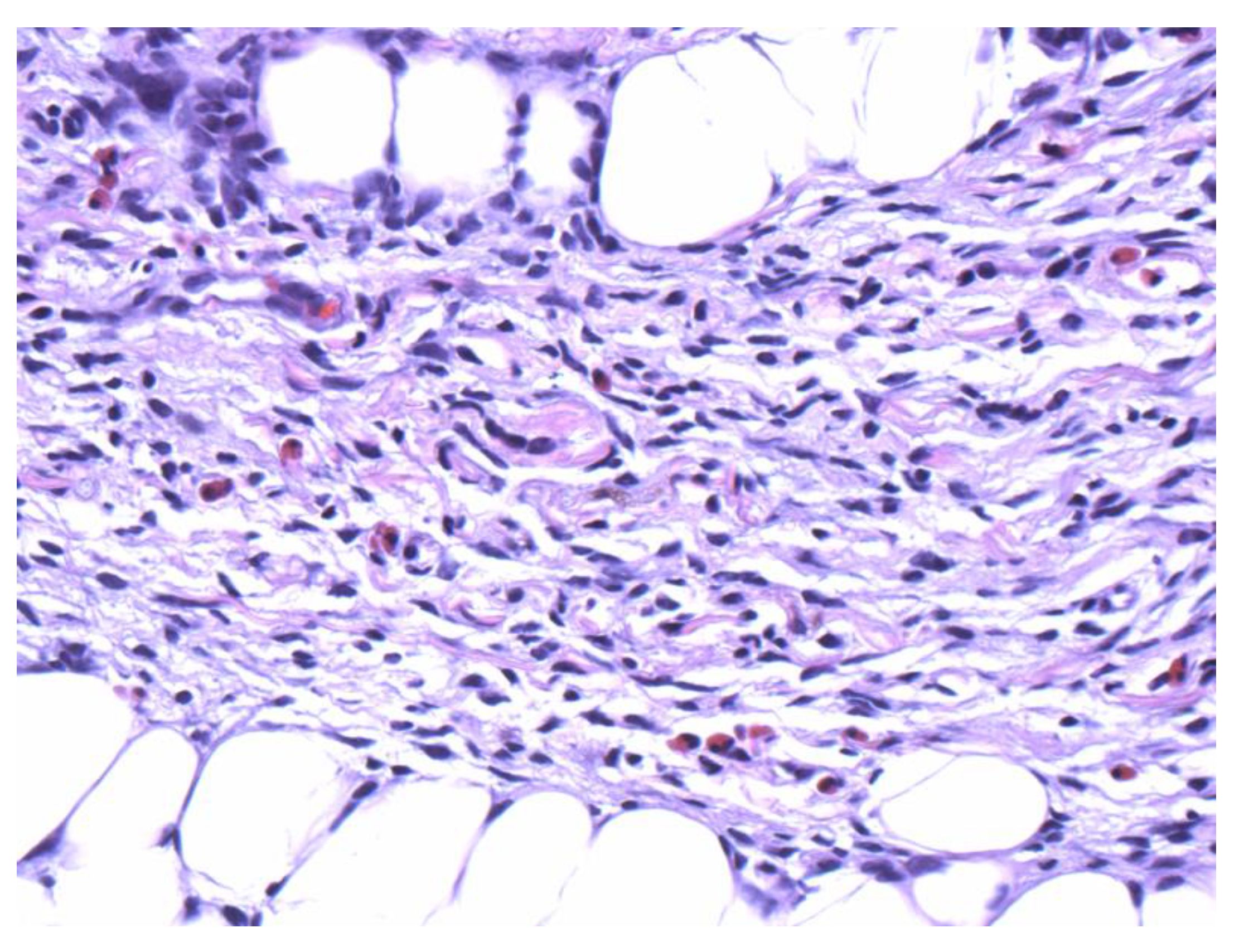 Dermatopathology 09 00044 g003