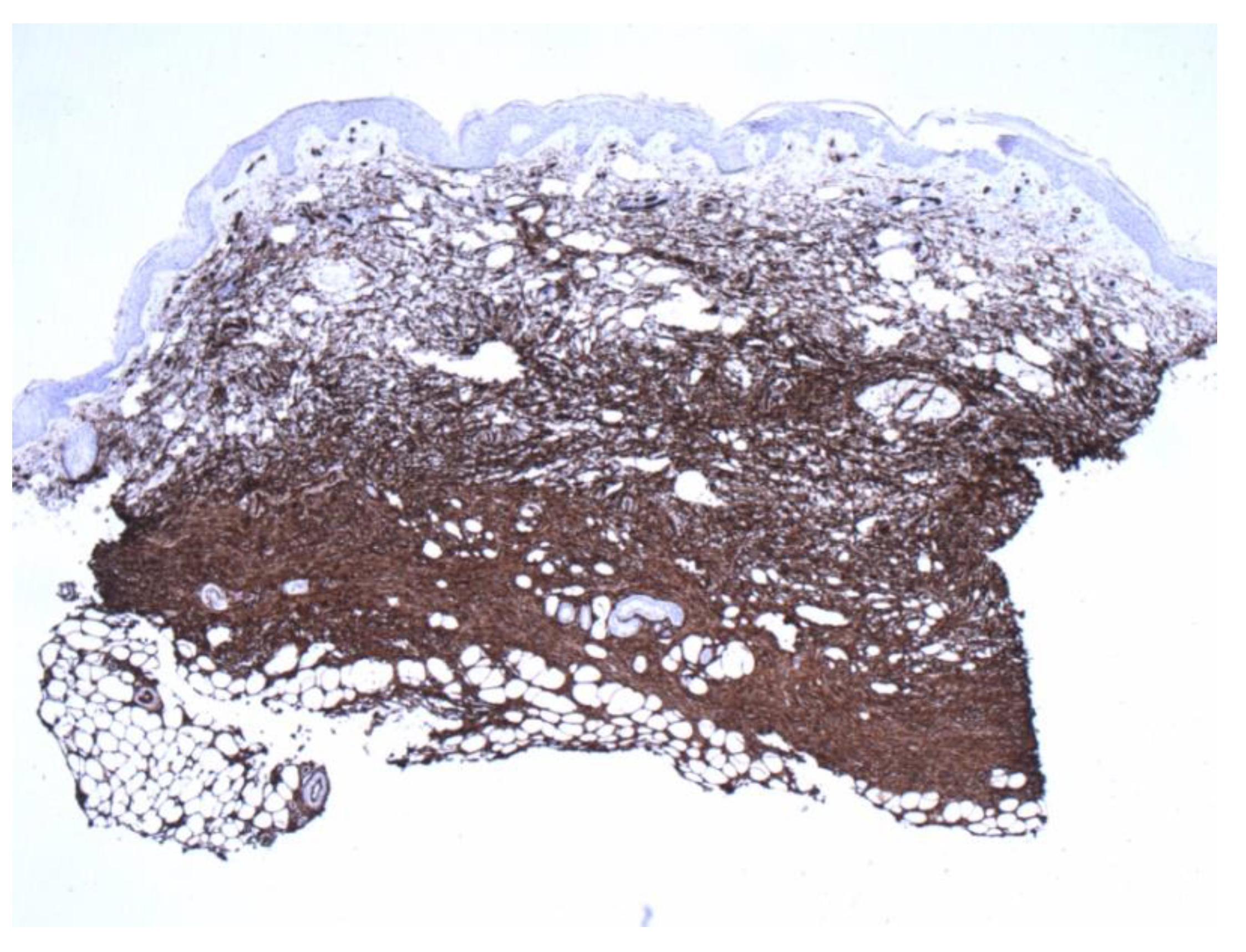 Dermatopathology 09 00044 g004