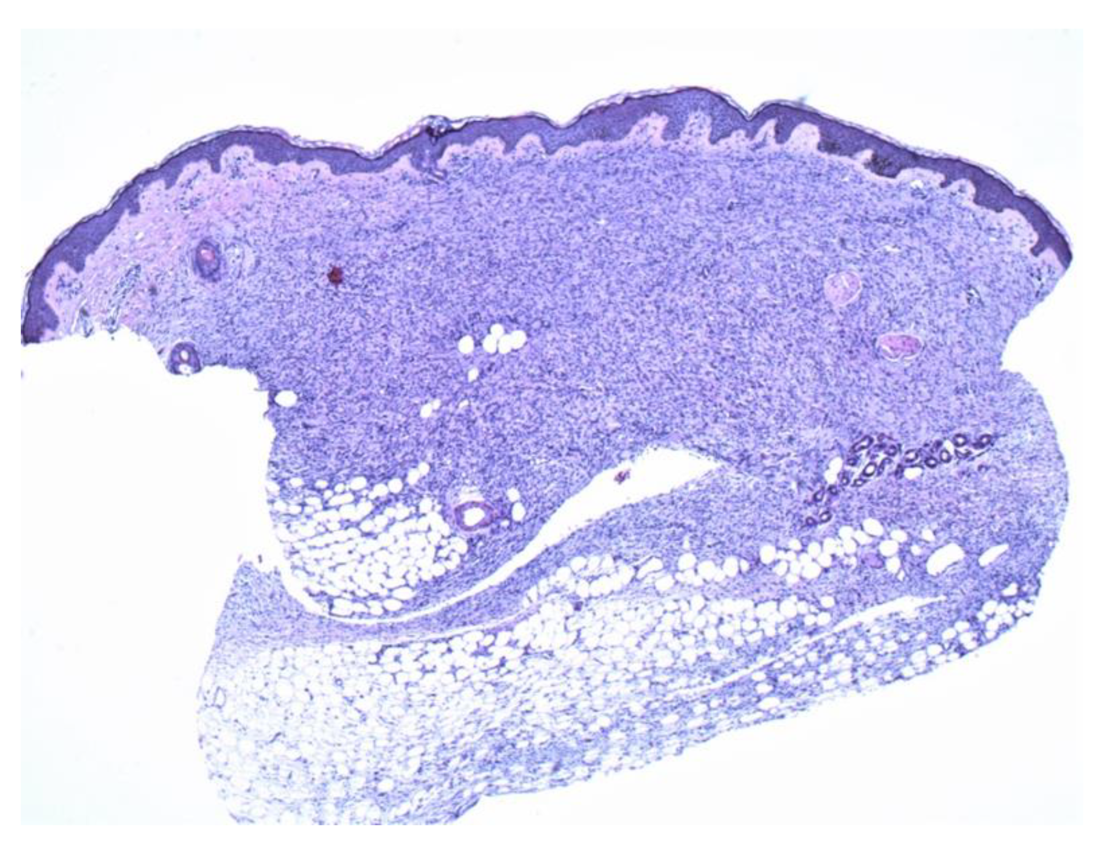 Dermatopathology 09 00044 g005