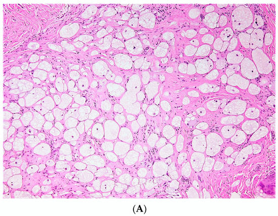 Dermatopathology 10 00001 g002a Dermatopathology 10 00001 g002a