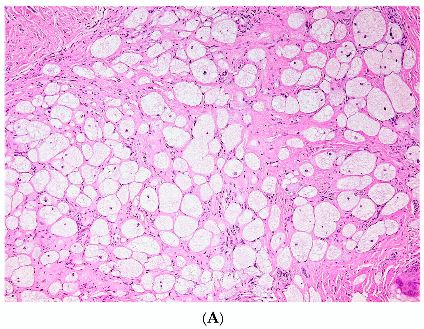 Dermatopathology 10 00001 g002a Dermatopathology 10 00001 g002a