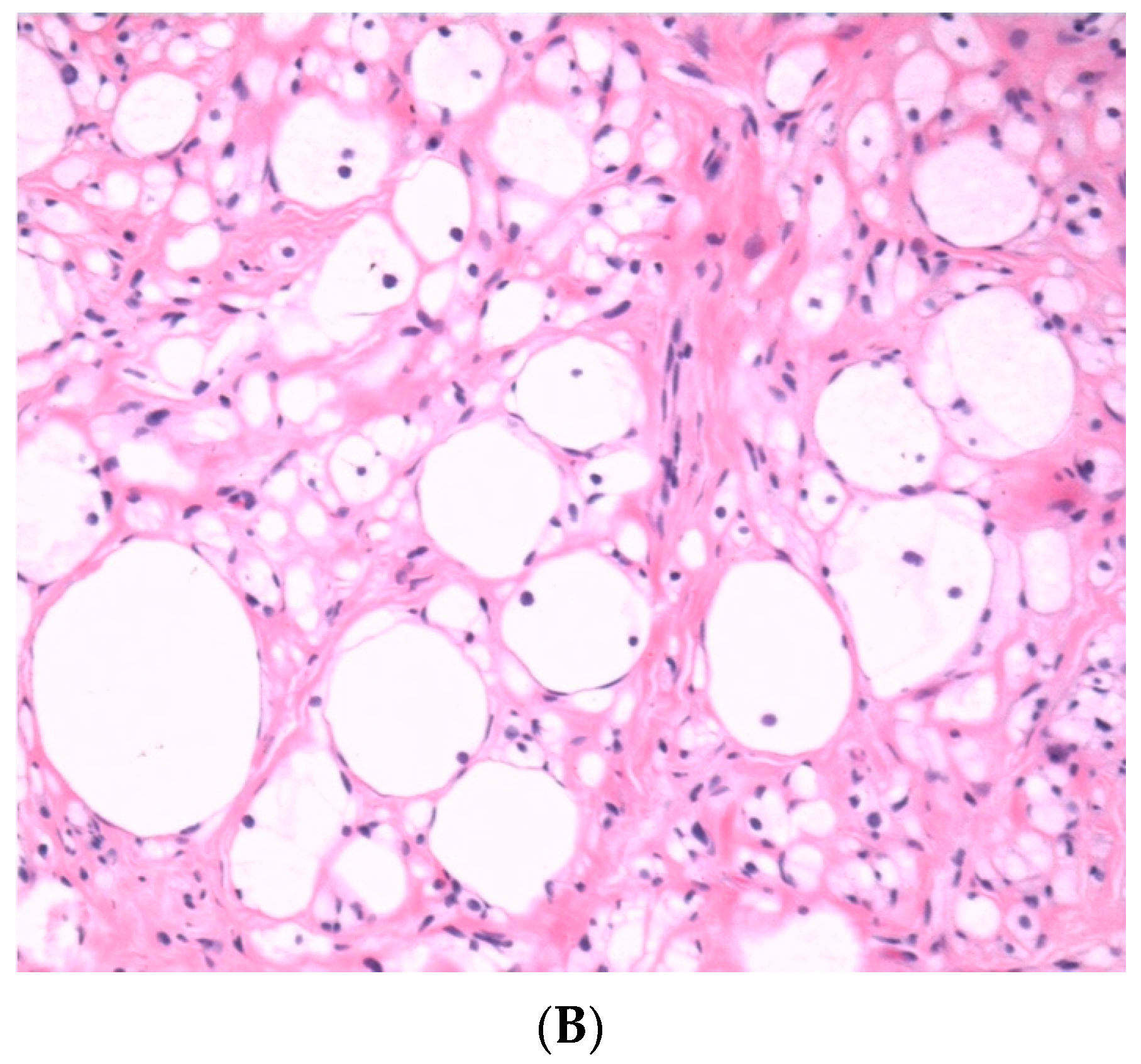 Dermatopathology 10 00001 g002b Dermatopathology 10 00001 g002b