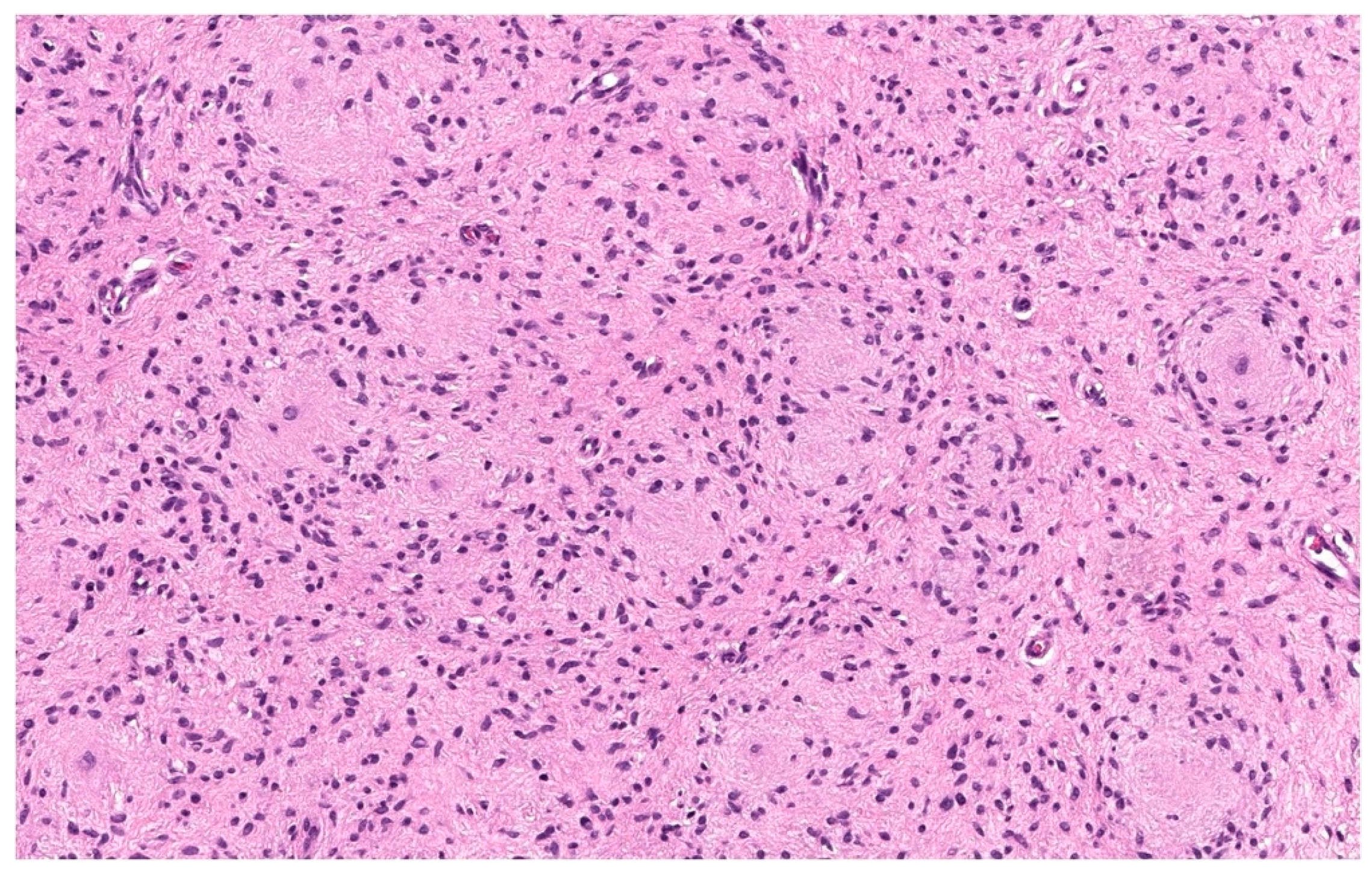 Dermatopathology 10 00001 g003 Dermatopathology 10 00001 g003