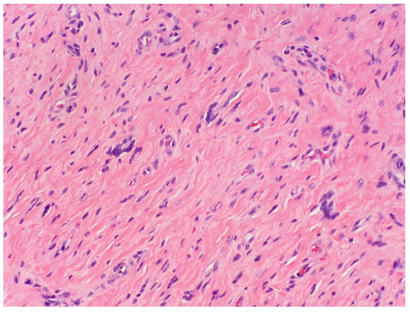 Dermatopathology 10 00001 g004 Dermatopathology 10 00001 g004