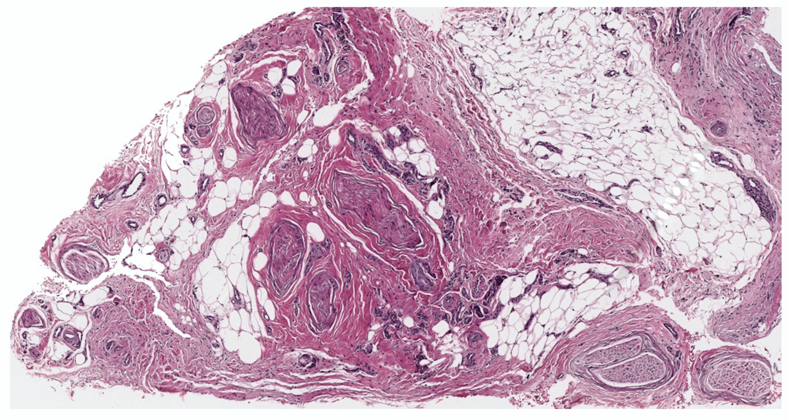 Dermatopathology 10 00001 g005 Dermatopathology 10 00001 g005