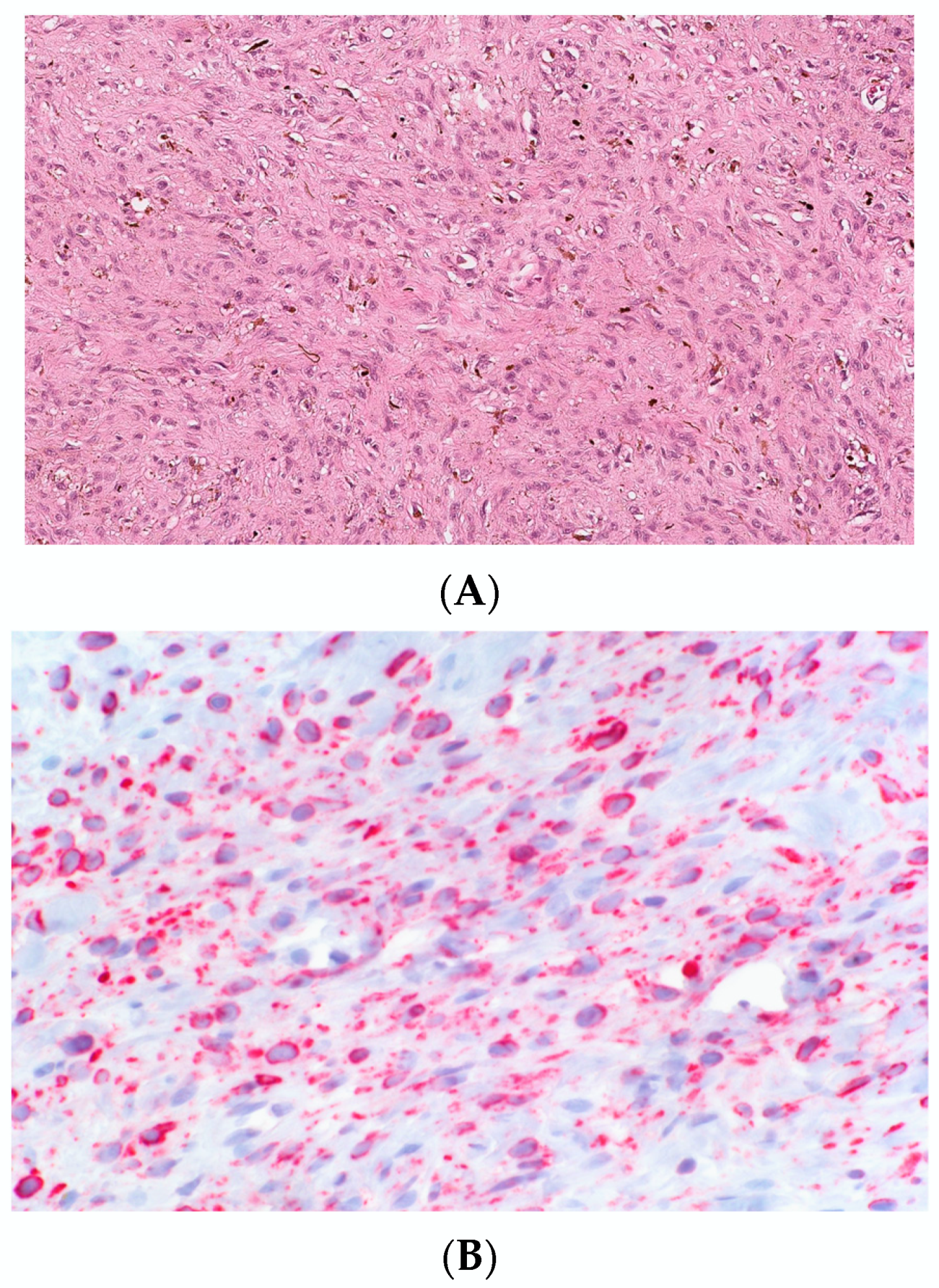 Dermatopathology 10 00001 g006 Dermatopathology 10 00001 g006