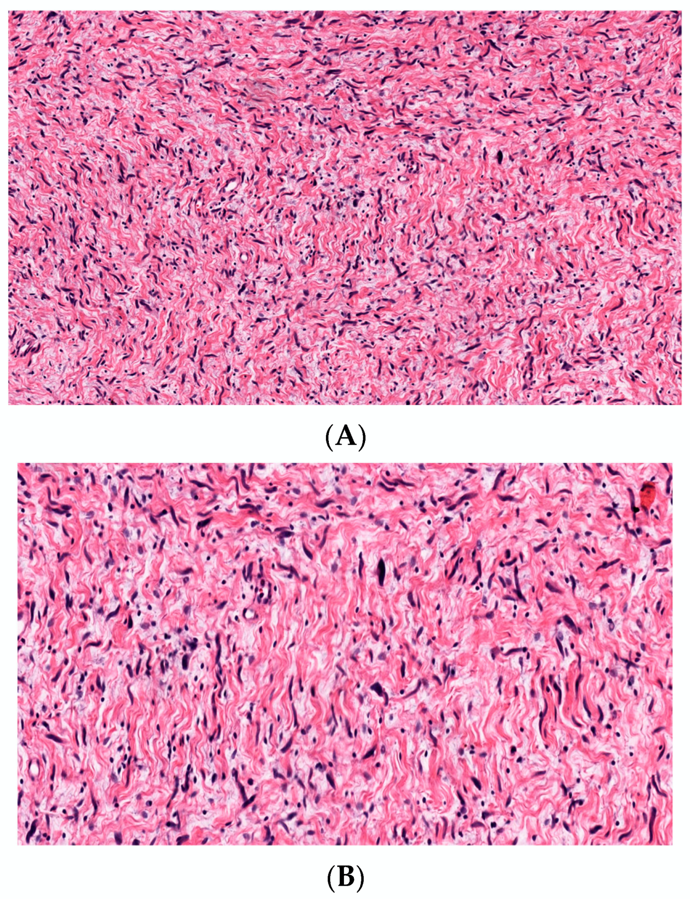 Dermatopathology 10 00001 g007 Dermatopathology 10 00001 g007