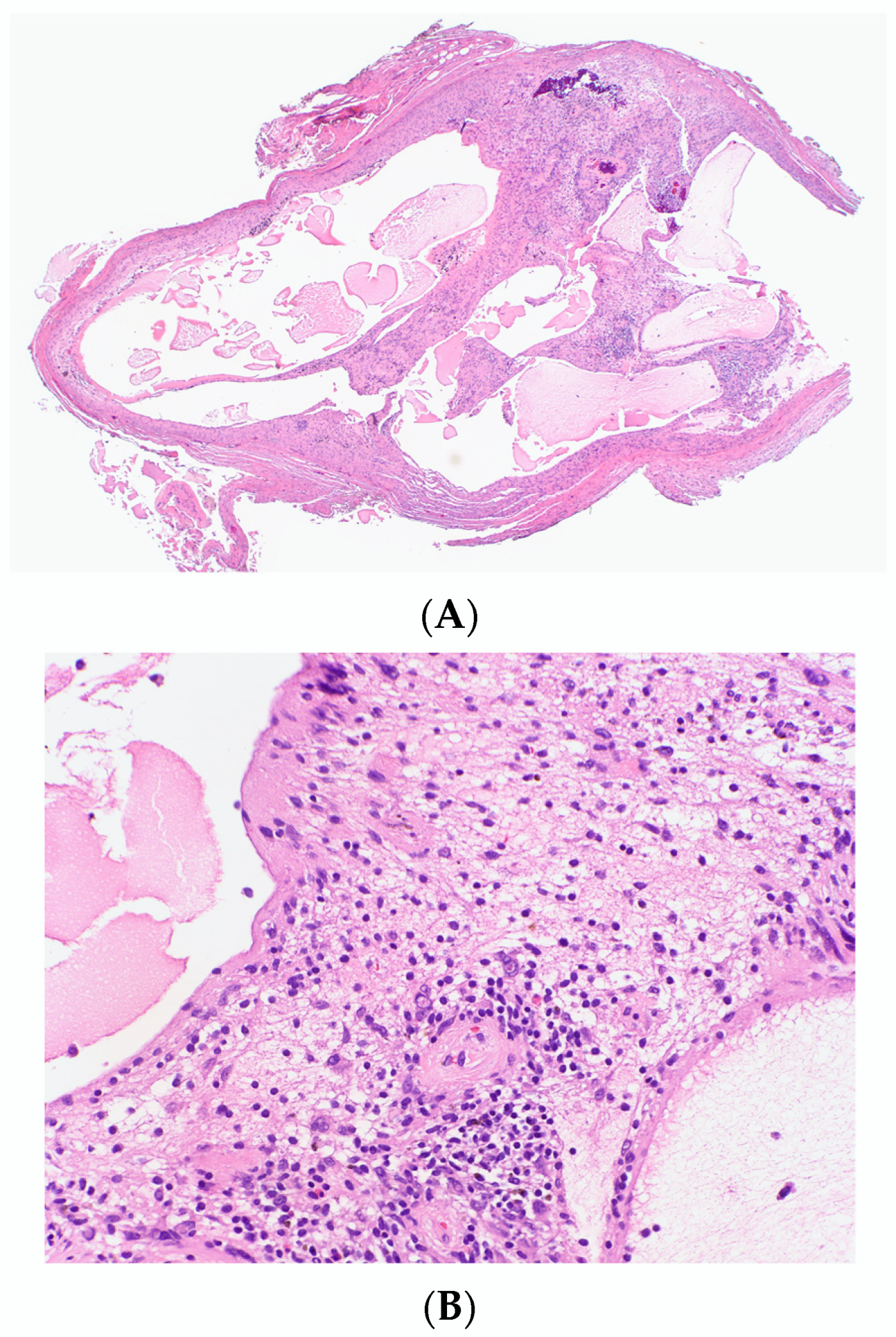 Dermatopathology 10 00001 g008 Dermatopathology 10 00001 g008