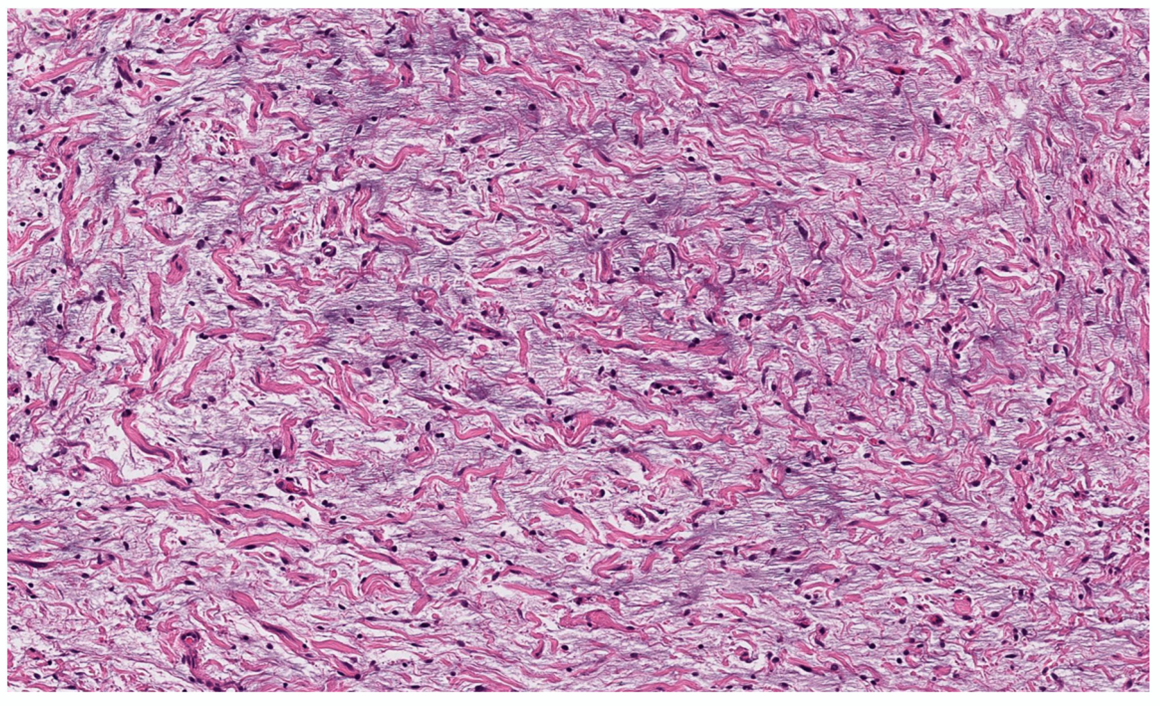 Dermatopathology 10 00001 g009 Dermatopathology 10 00001 g009
