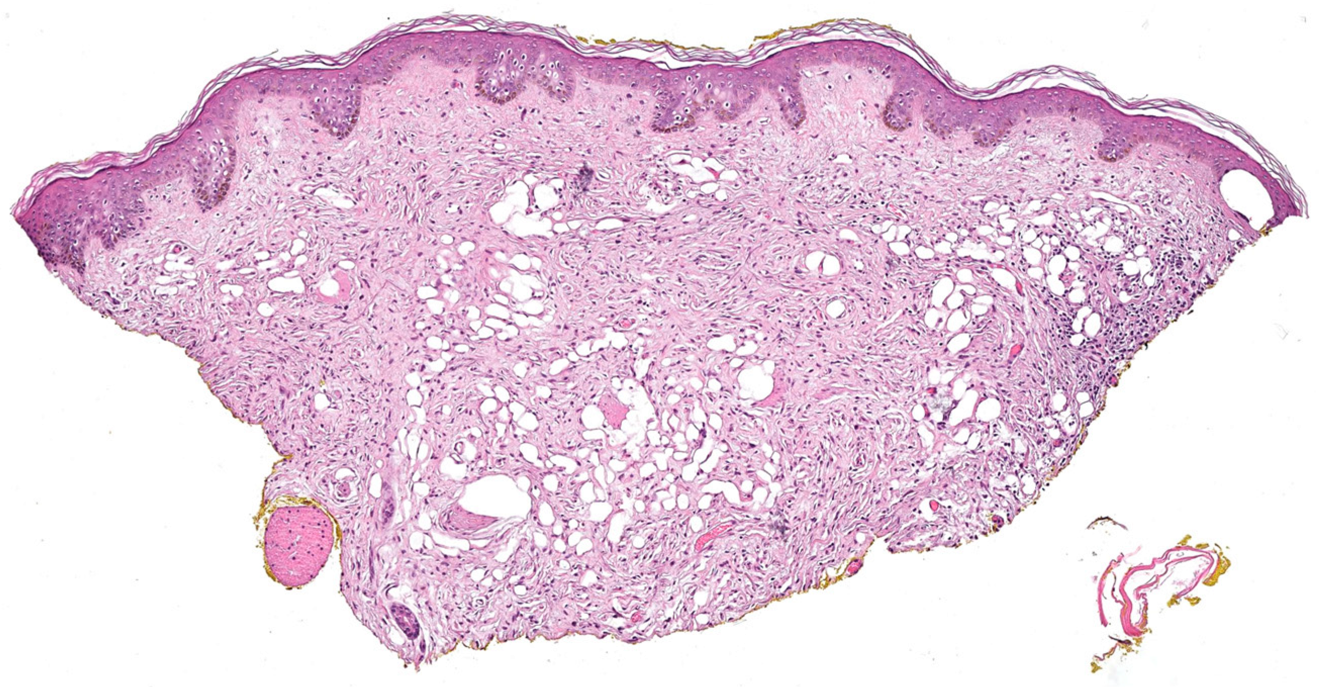 Dermatopathology 10 00001 g011 Dermatopathology 10 00001 g011