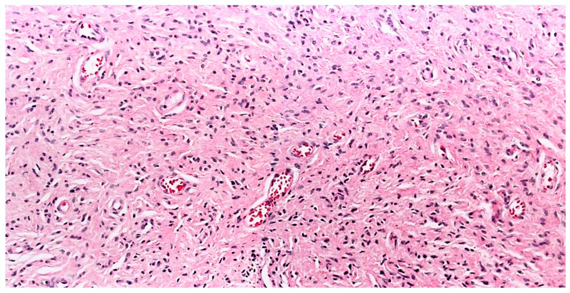 Dermatopathology 10 00001 g012 Dermatopathology 10 00001 g012