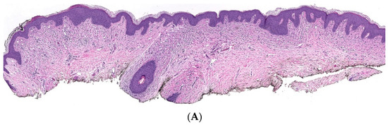 Dermatopathology 10 00001 g013a Dermatopathology 10 00001 g013a