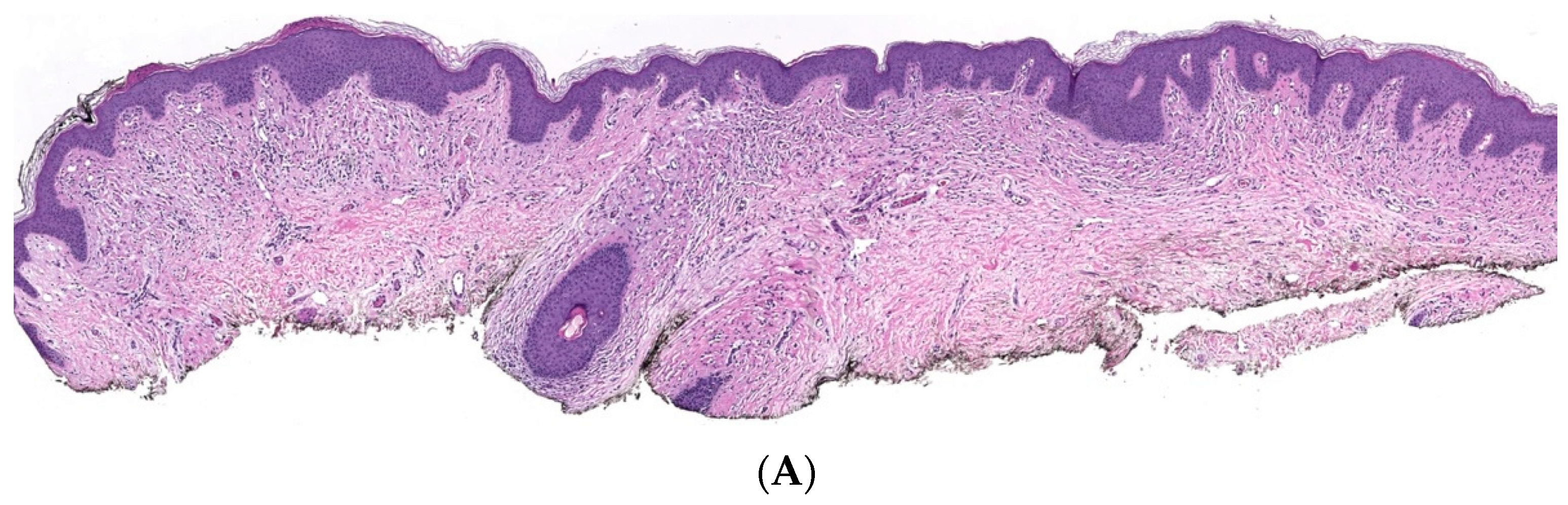 Dermatopathology 10 00001 g013a Dermatopathology 10 00001 g013a