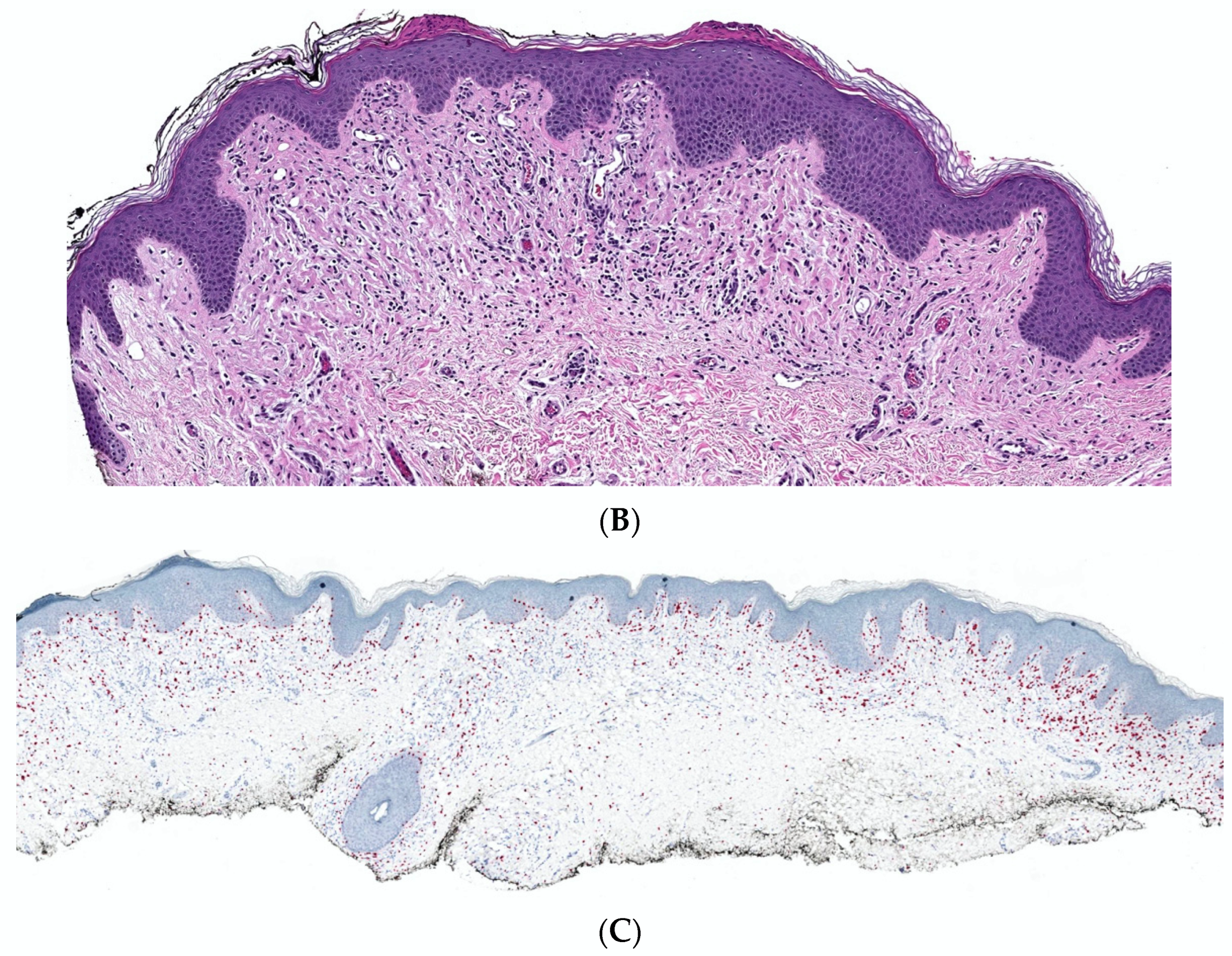 Dermatopathology 10 00001 g013b Dermatopathology 10 00001 g013b
