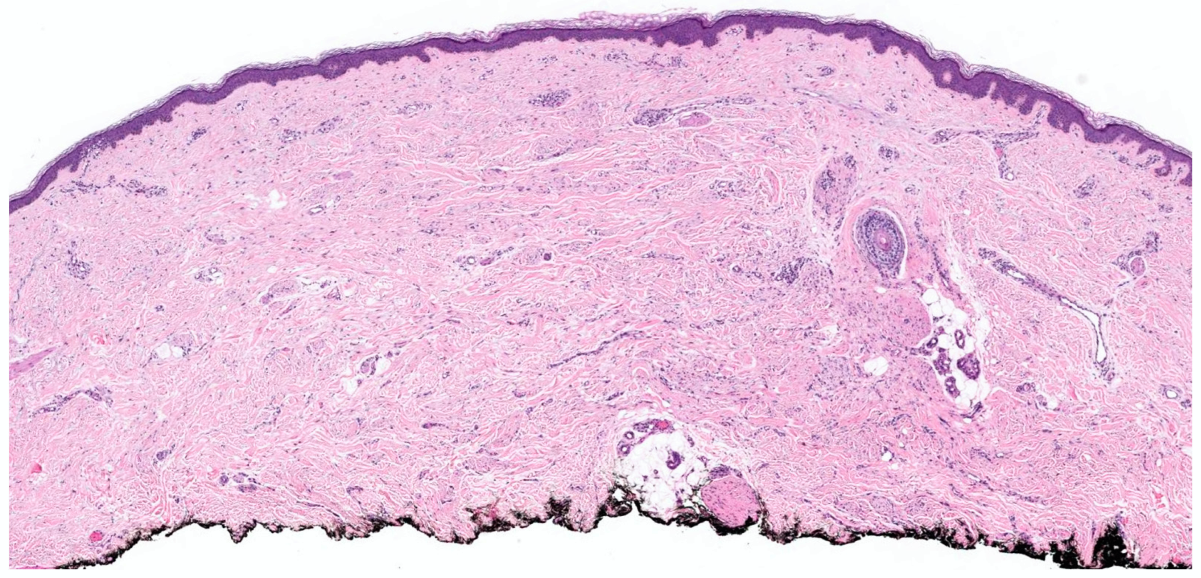 Dermatopathology 10 00001 g014 Dermatopathology 10 00001 g014
