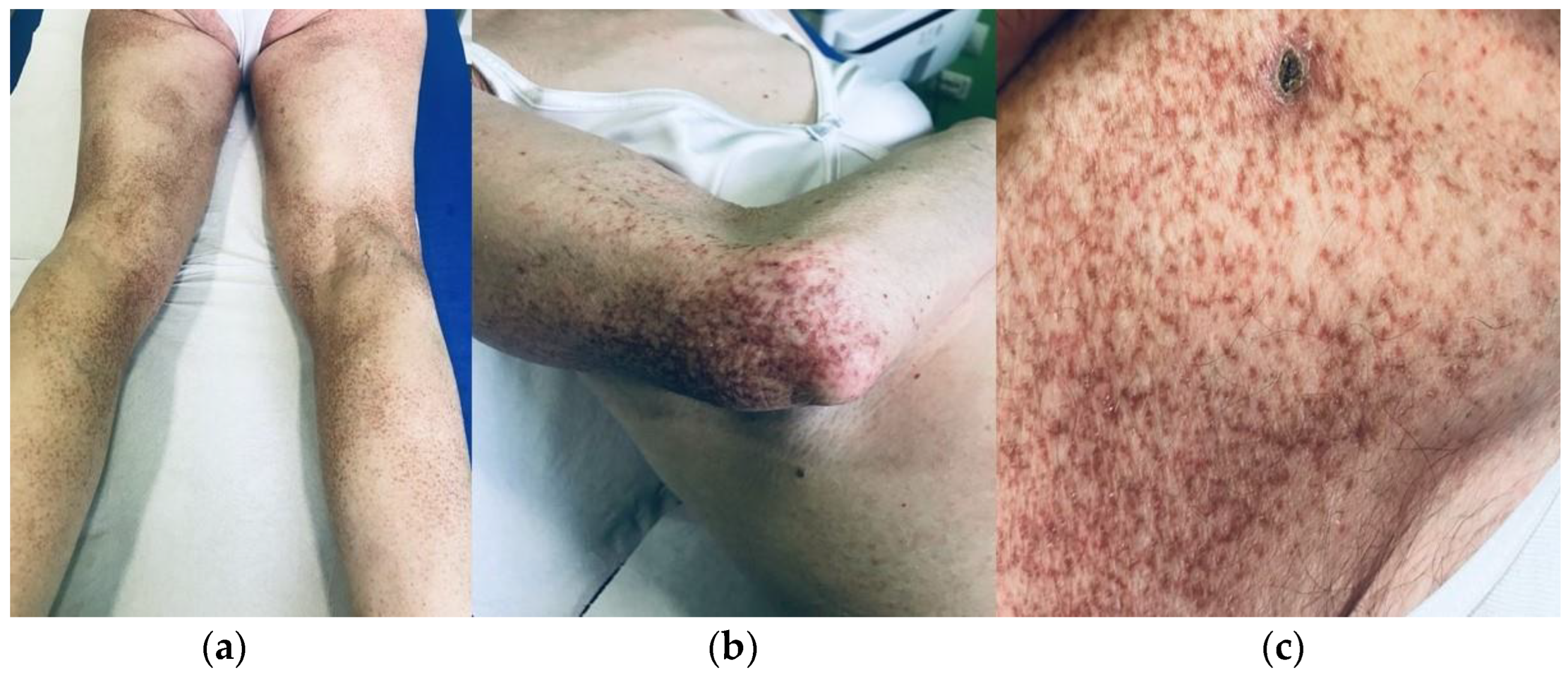Dermatopathology 10 00006 g001 Dermatopathology 10 00006 g001