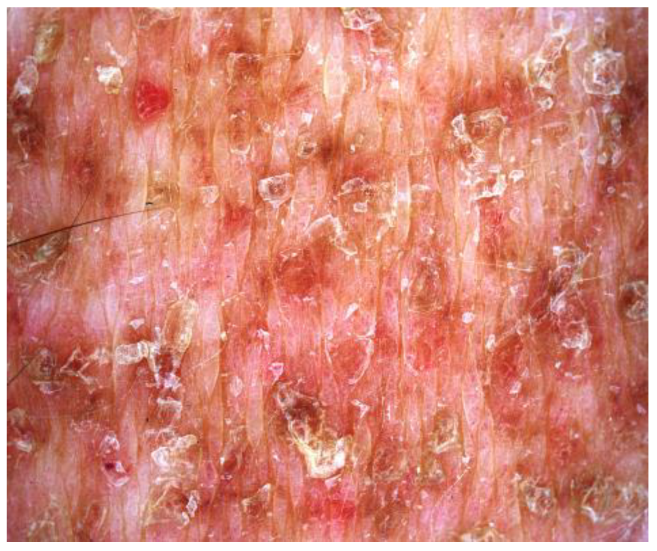 Dermatopathology 10 00006 g002 Dermatopathology 10 00006 g002