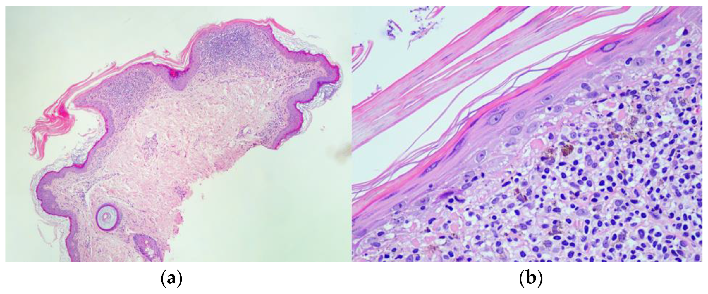 Dermatopathology 10 00006 g003 Dermatopathology 10 00006 g003