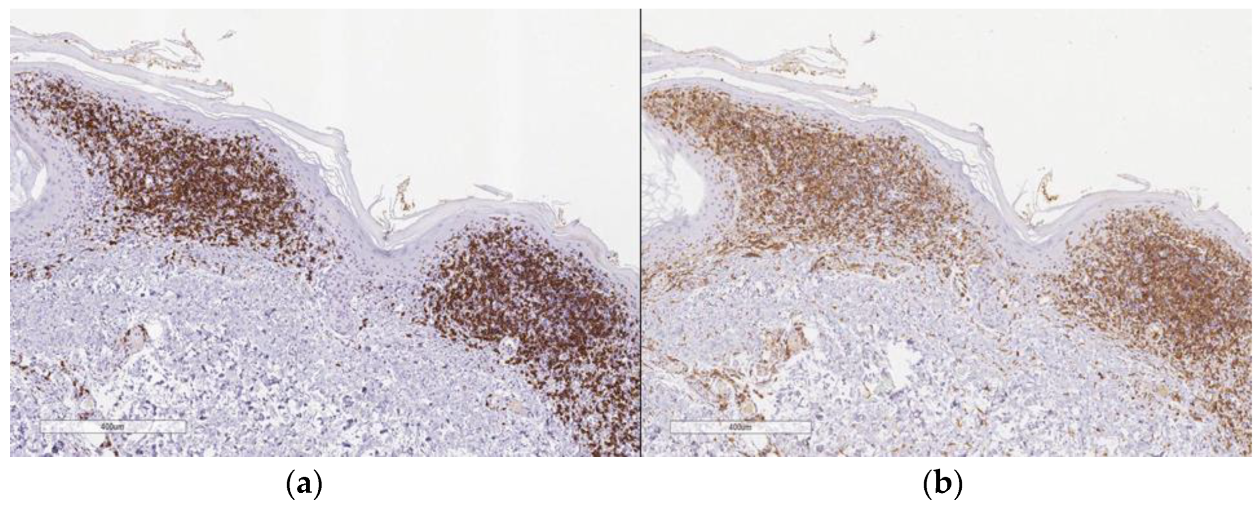 Dermatopathology 10 00006 g004 Dermatopathology 10 00006 g004