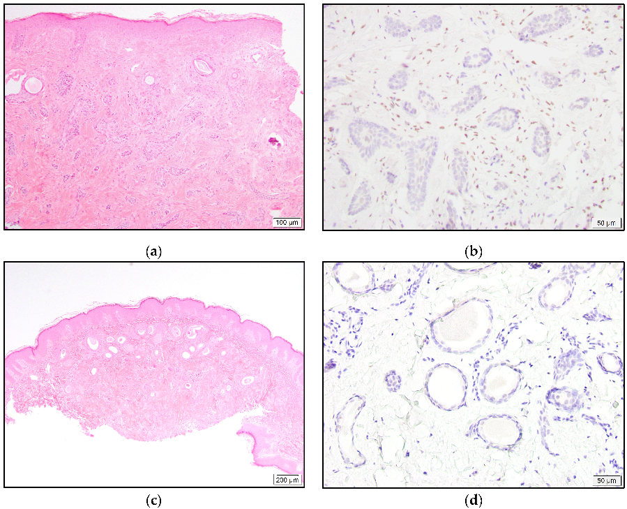 Dermatopathology 10 00011 g006