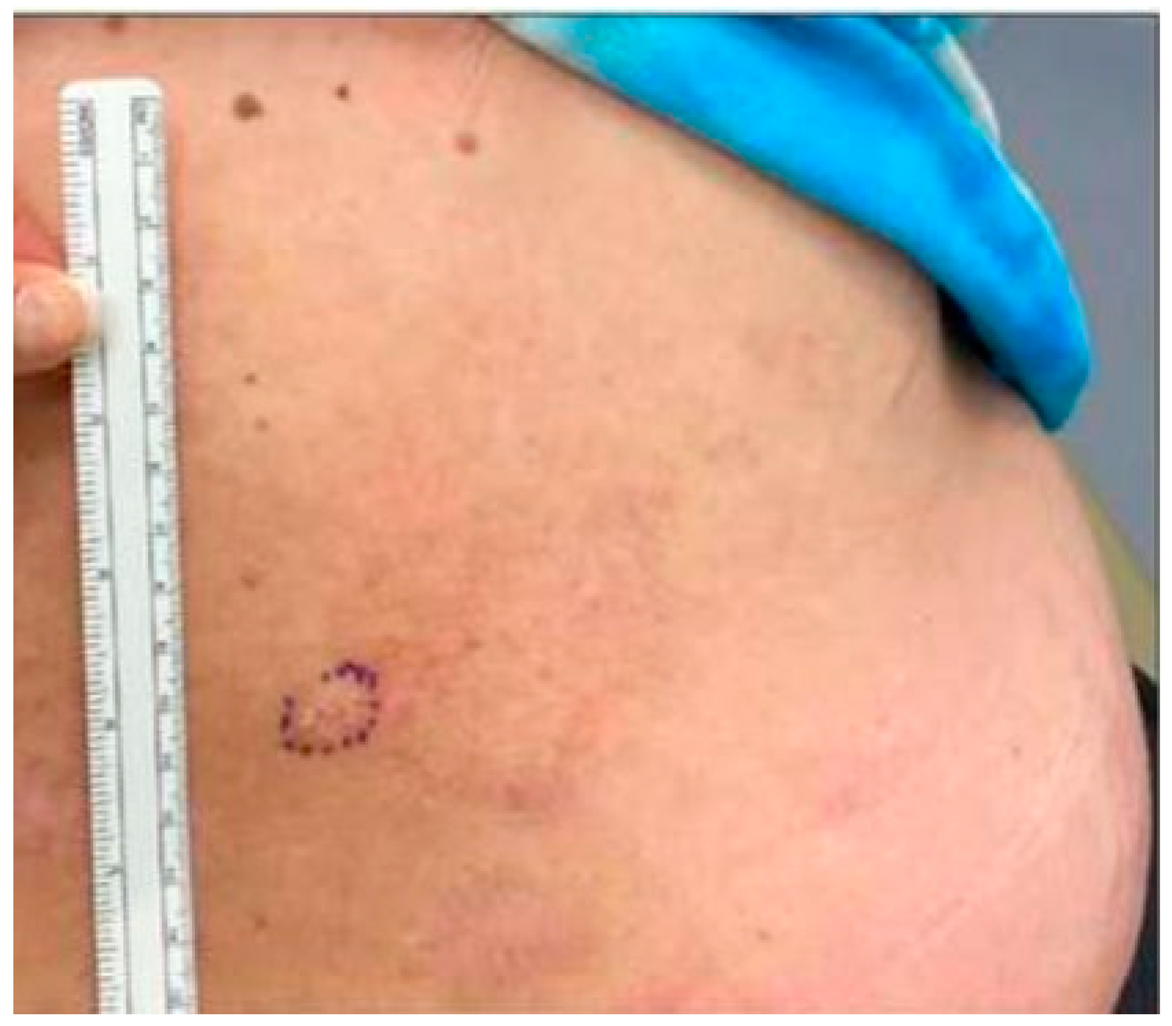 Dermatopathology 10 00012 g001