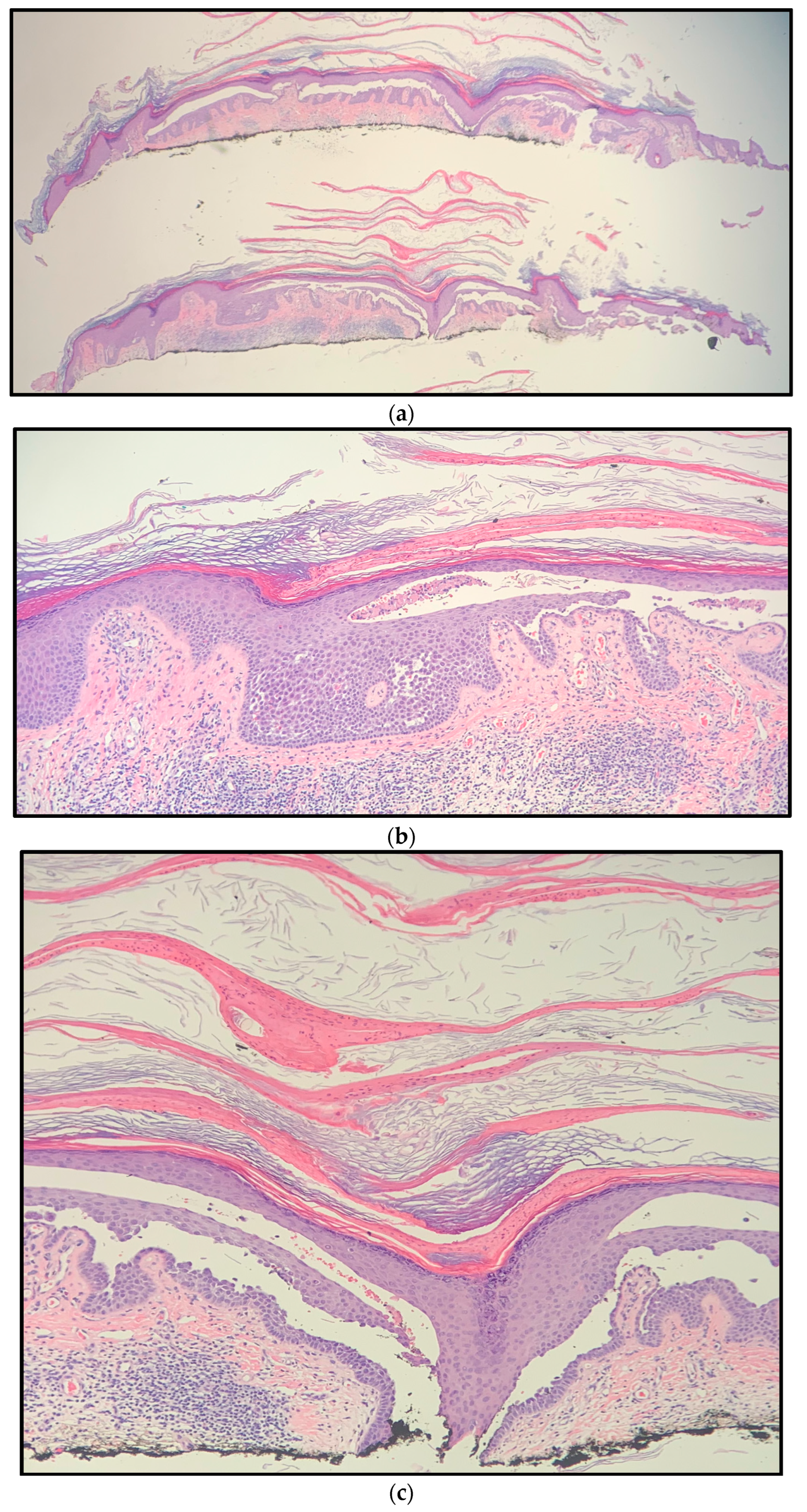 Dermatopathology 10 00012 g002
