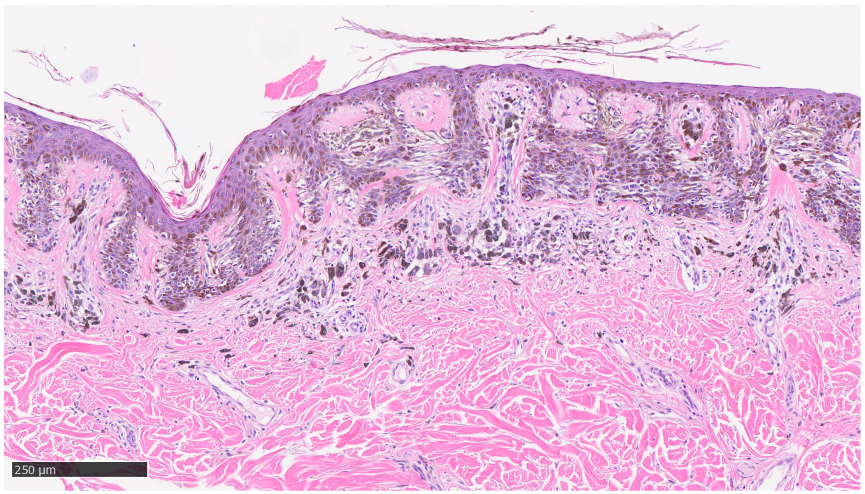 Dermatopathology 10 00018 g002