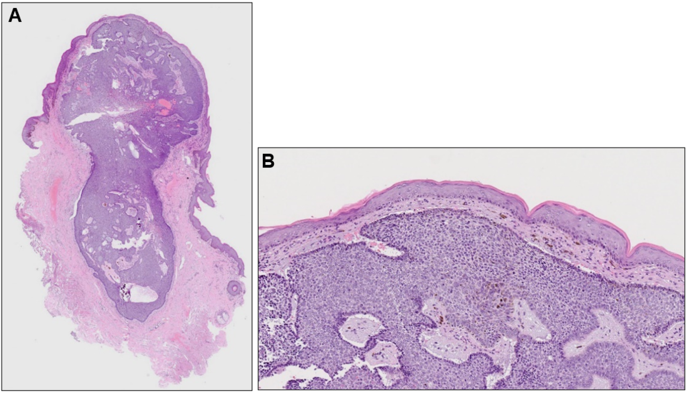 Dermatopathology 10 00019 g002