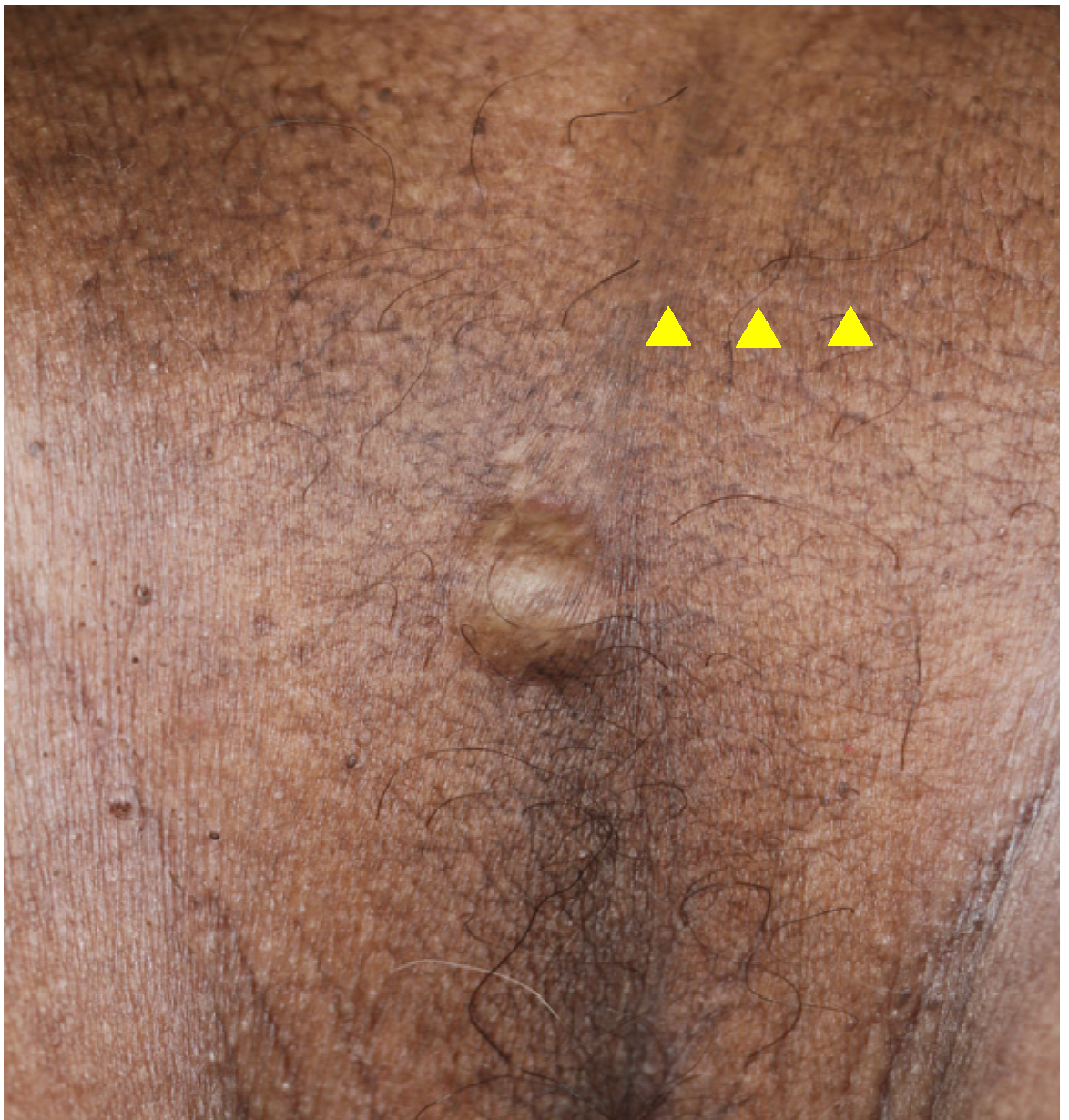 Dermatopathology 10 00019 g003