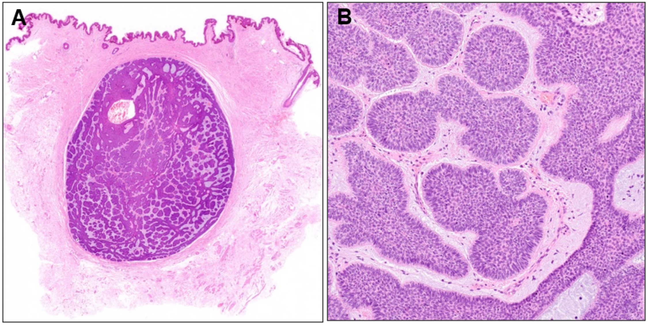 Dermatopathology 10 00019 g004