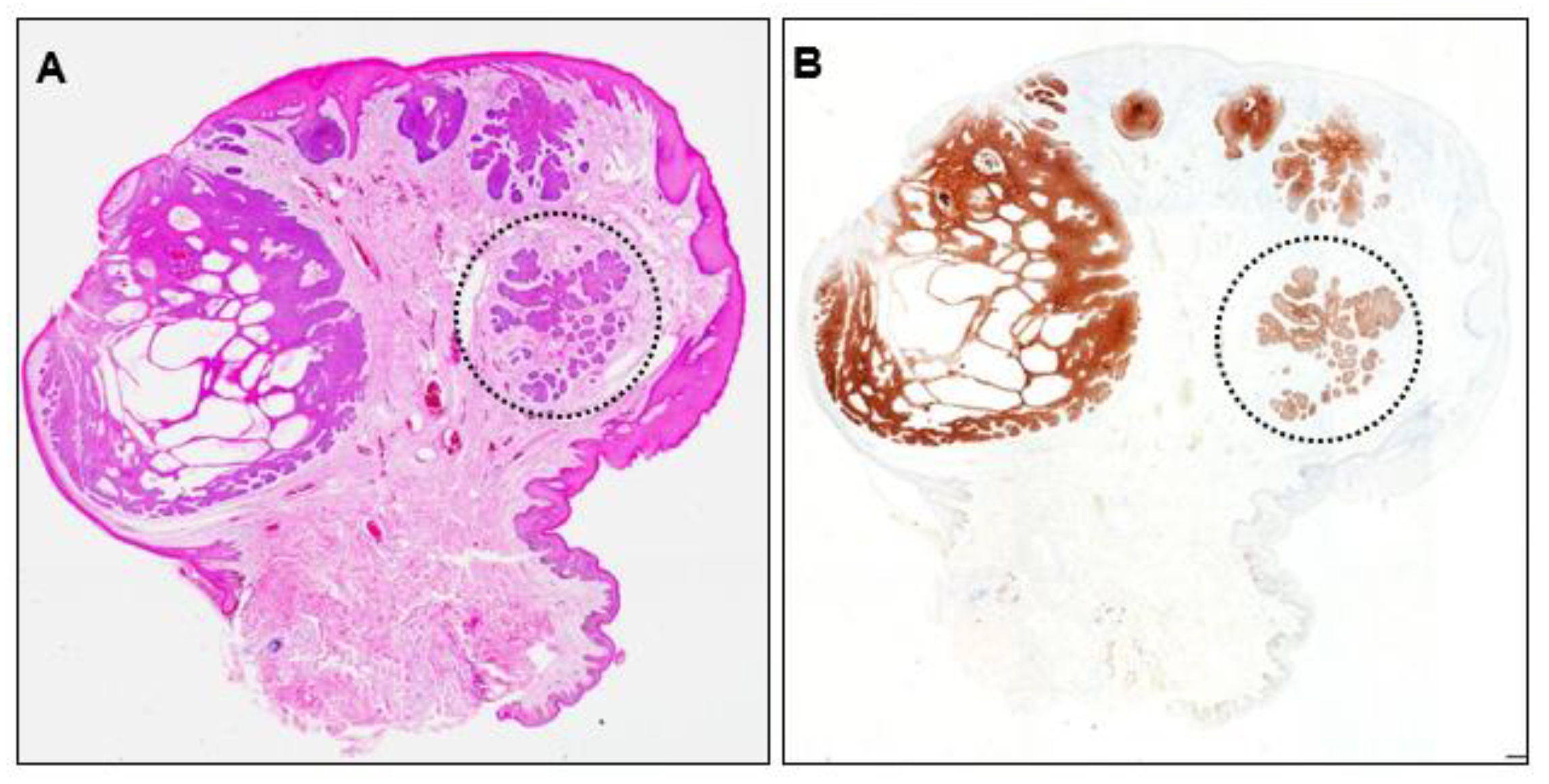 Dermatopathology 10 00019 g005