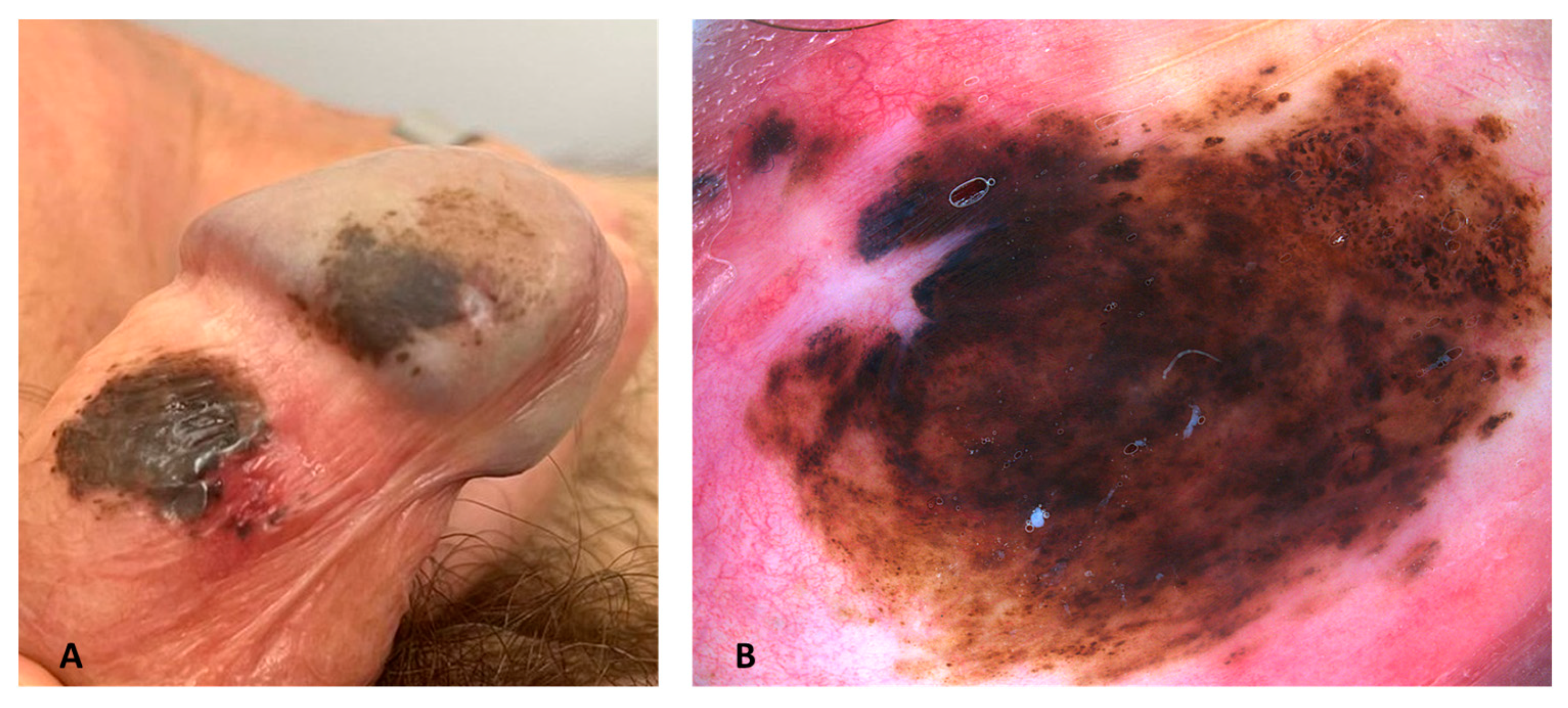 Dermatopathology 10 00022 g001