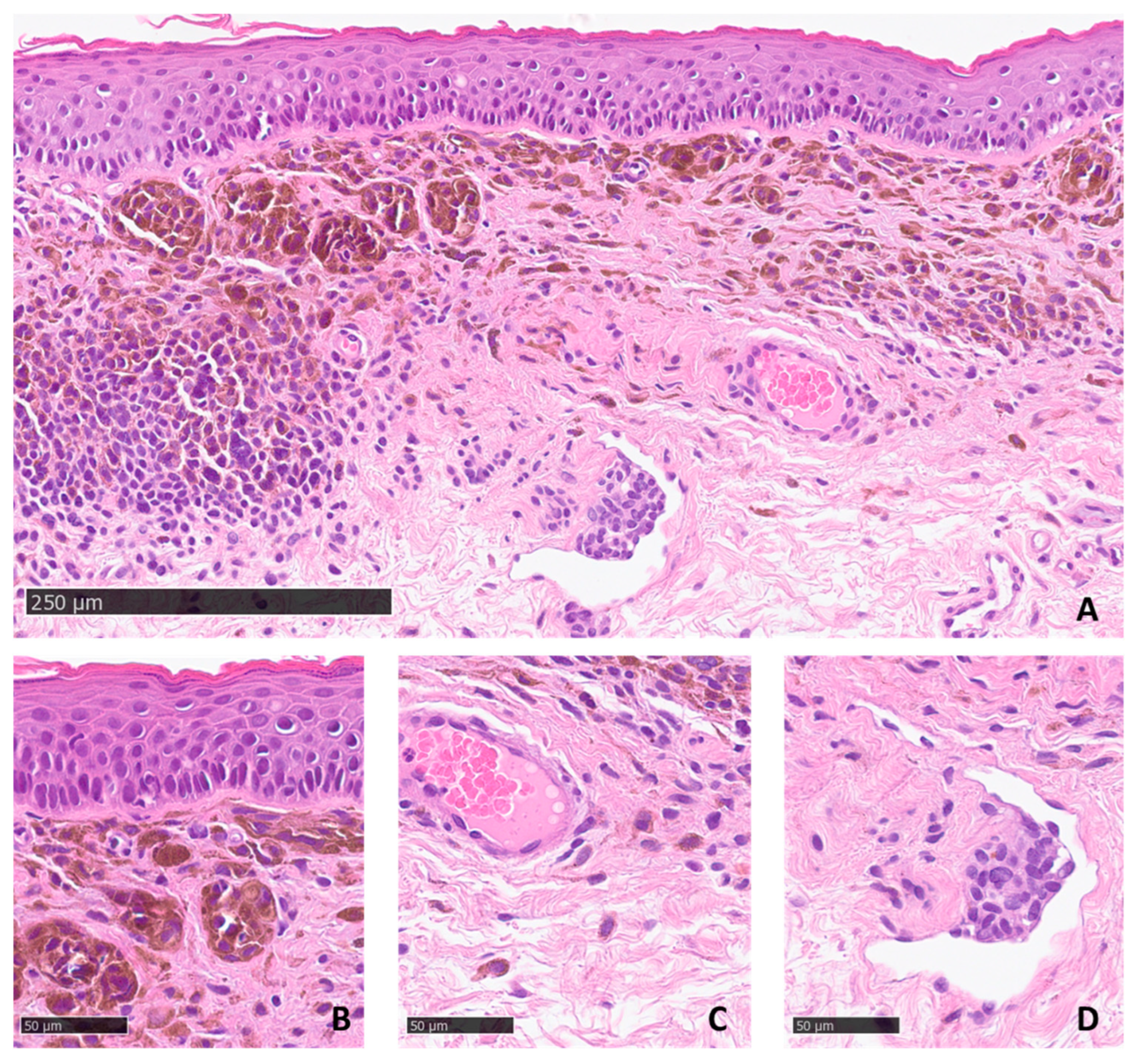 Dermatopathology 10 00022 g003