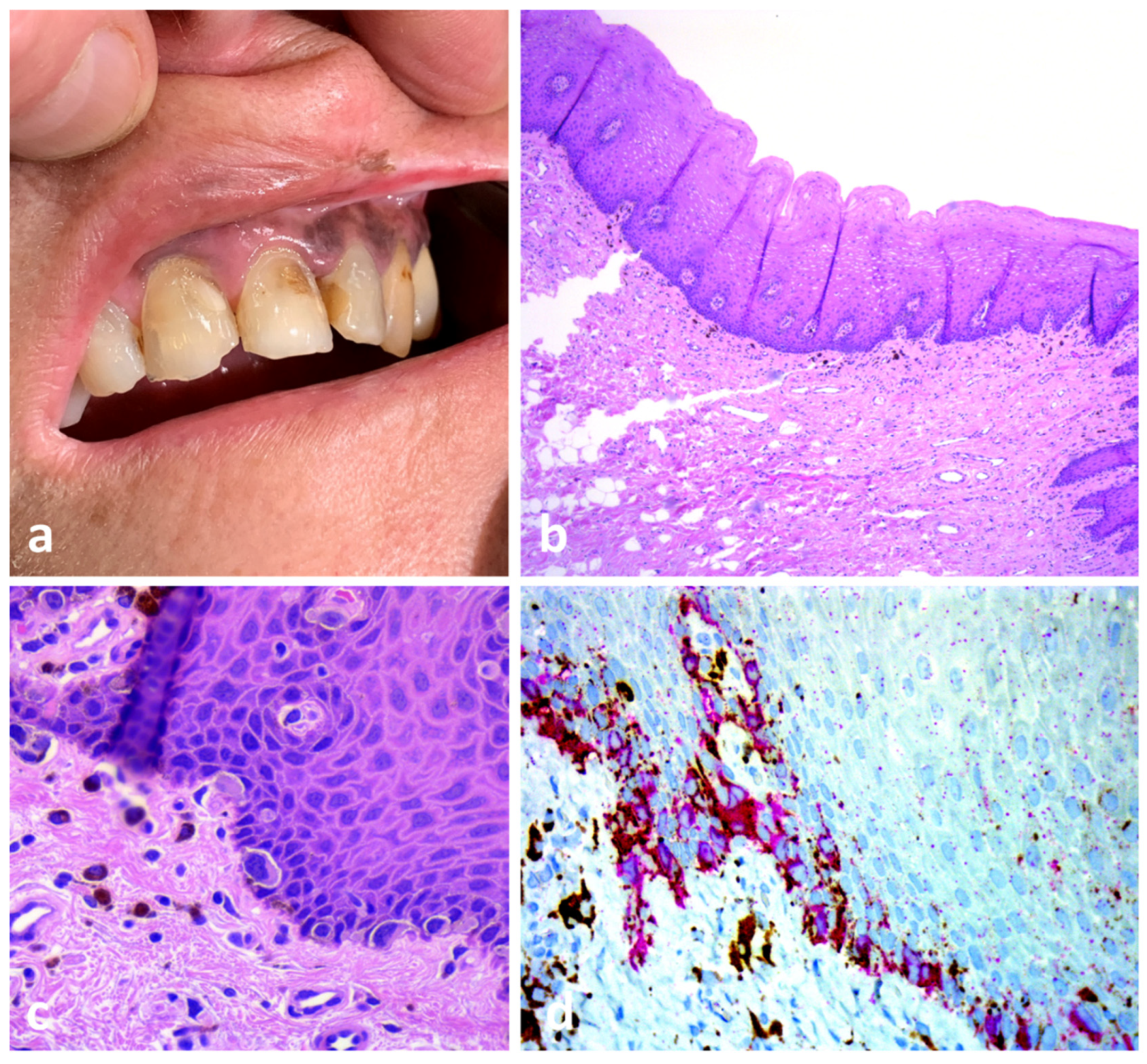 Dermatopathology 10 00023 g004