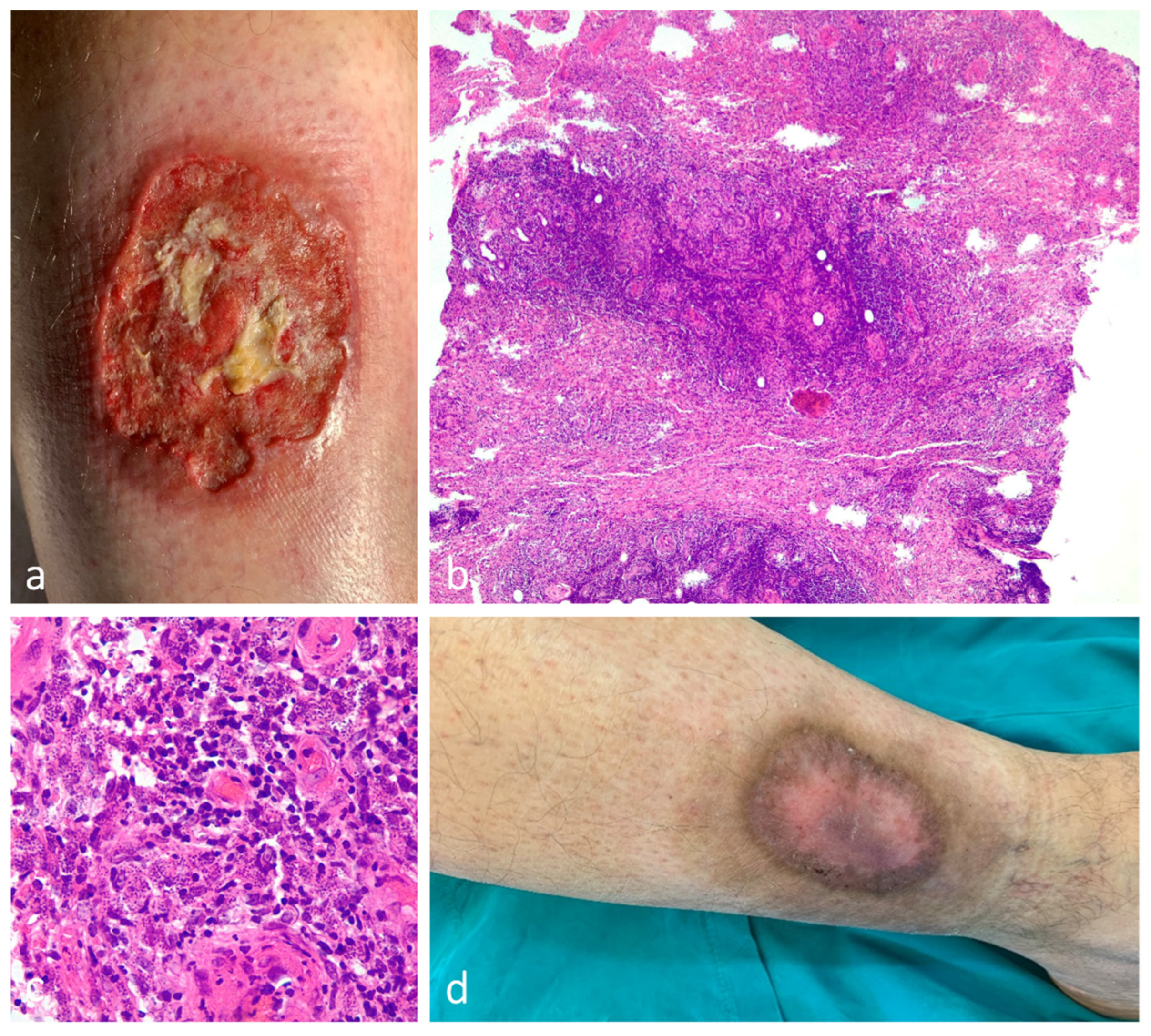 Dermatopathology 10 00023 g006