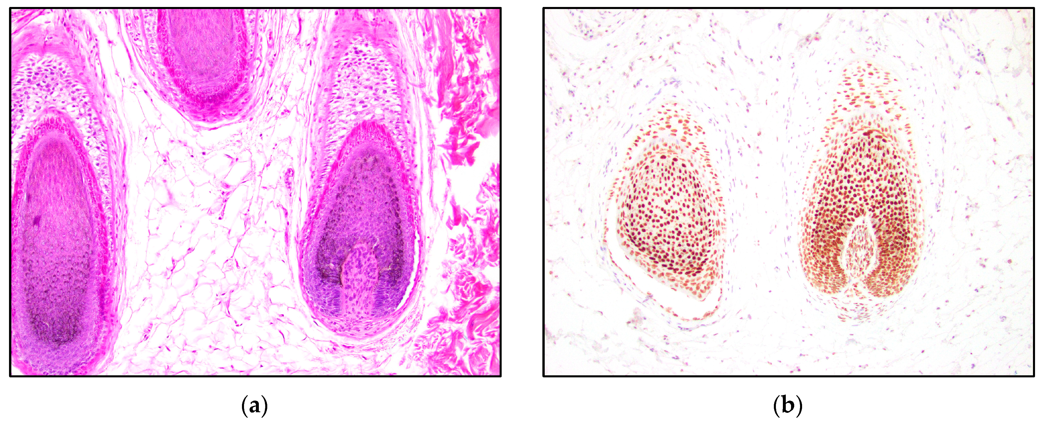 Dermatopathology 10 00025 g005 Dermatopathology 10 00025 g005
