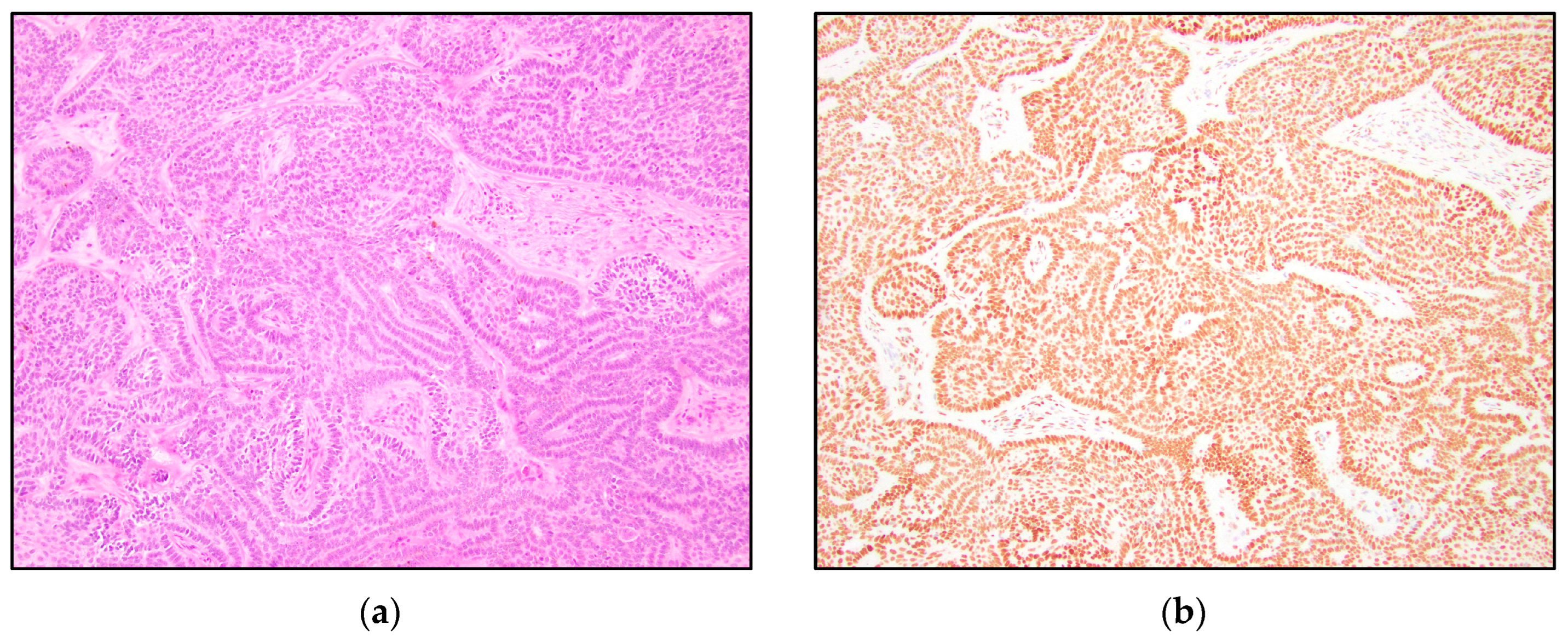 Dermatopathology 10 00025 g006 Dermatopathology 10 00025 g006