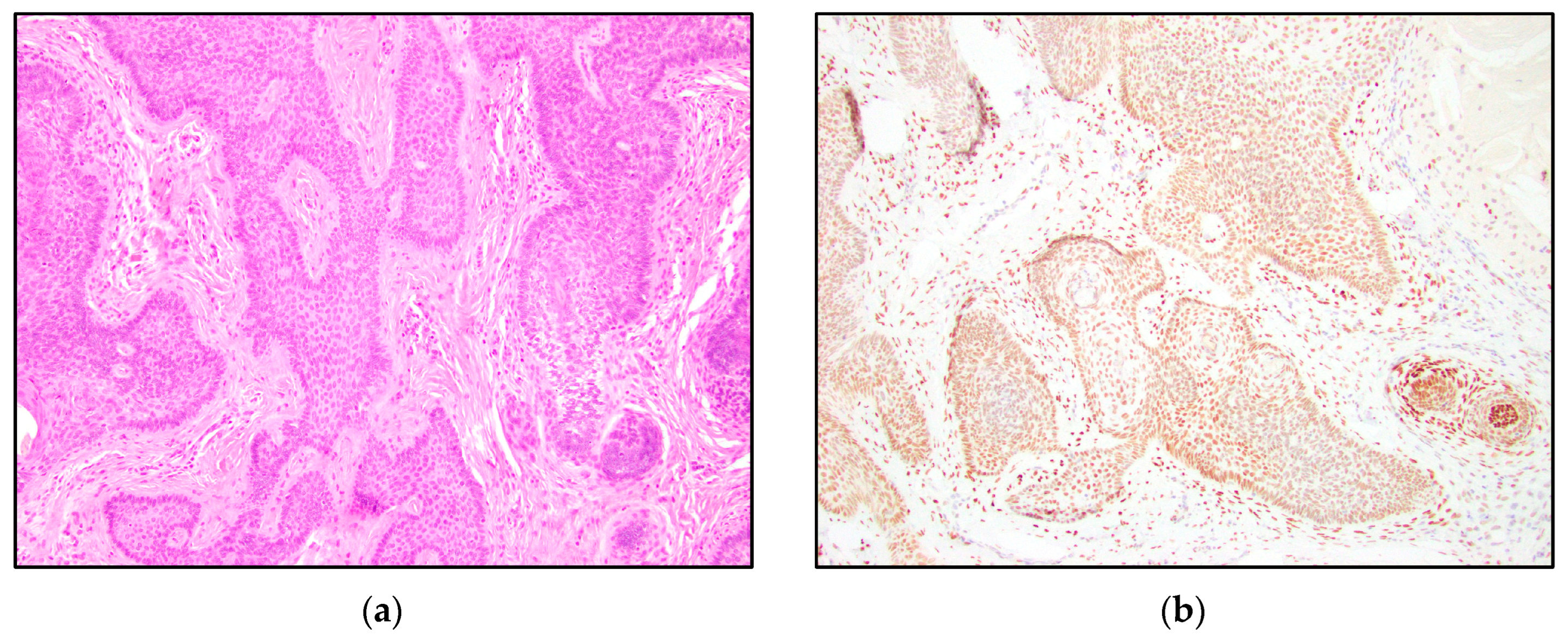 Dermatopathology 10 00025 g007 Dermatopathology 10 00025 g007