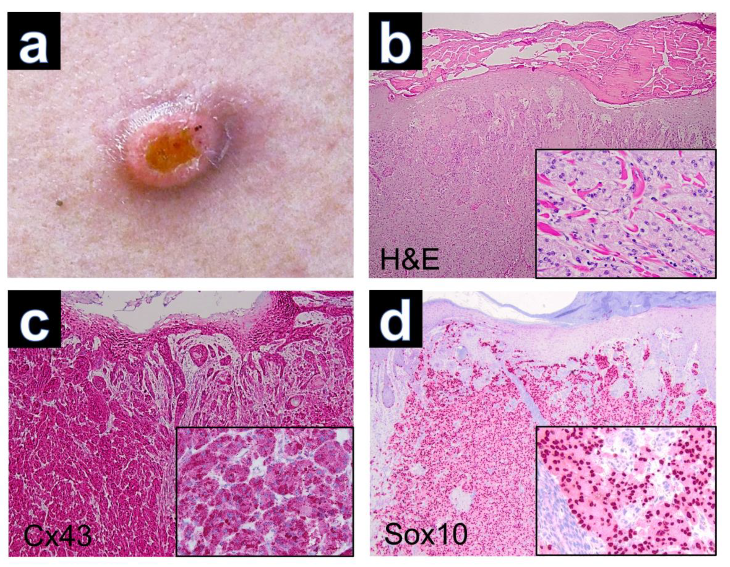 Dermatopathology 10 00026 g001