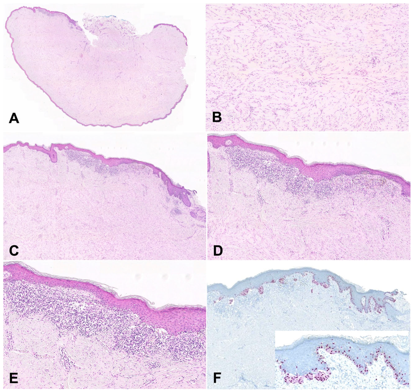 Dermatopathology 10 00028 g001 Dermatopathology 10 00028 g001