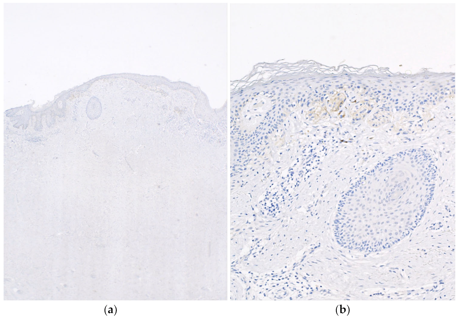 Dermatopathology 10 00028 g002 Dermatopathology 10 00028 g002