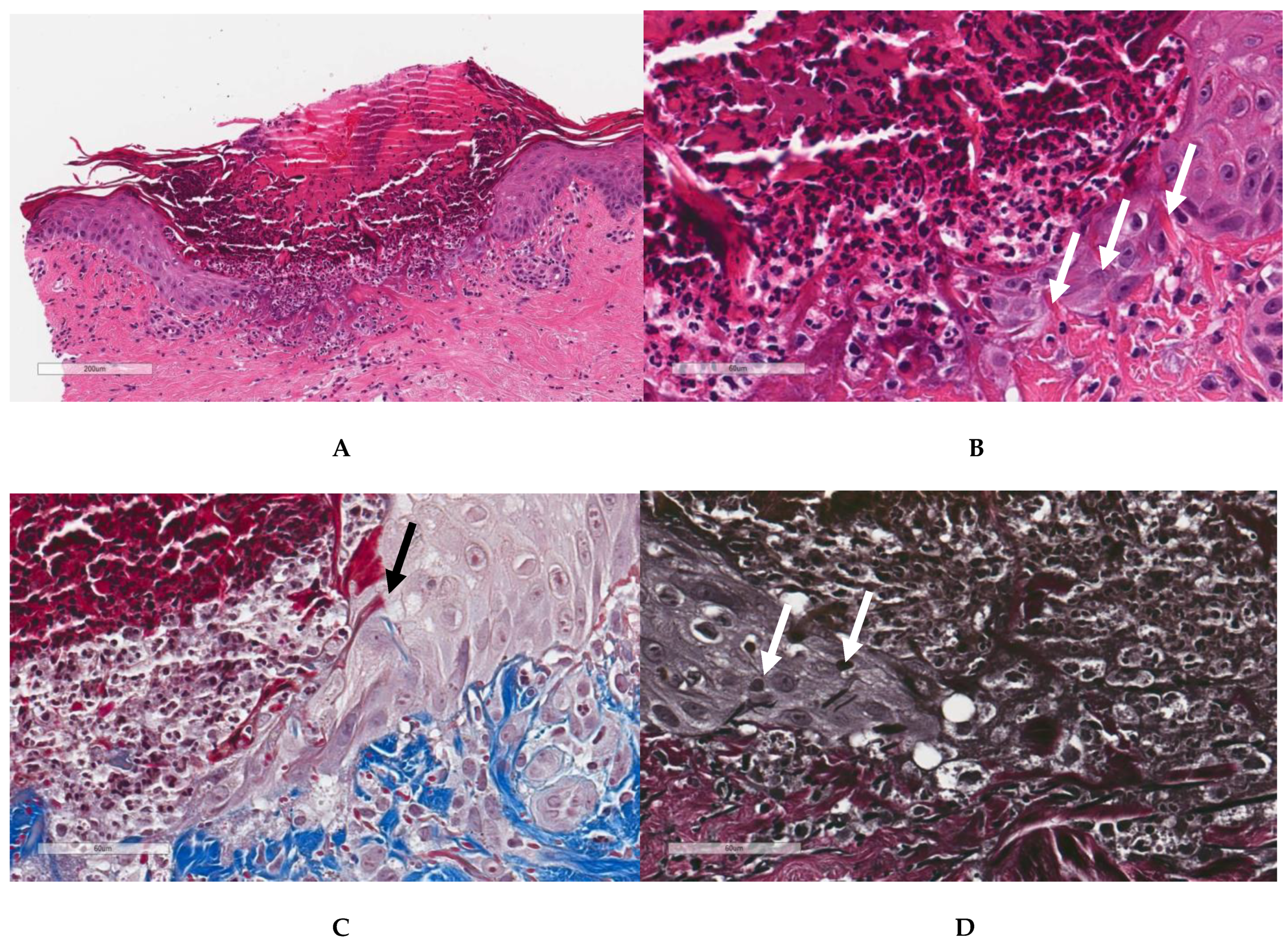 Dermatopathology 10 00029 g0a1